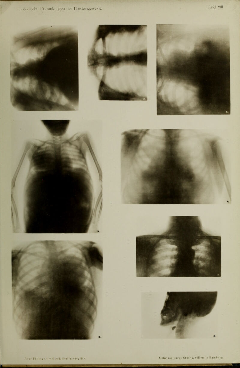 - 11()l/knLvlu. lukrankuiiLivn (Ilt IiruMcin^cwckle. 'l alcl vin \. iii h. I'.i tliii '‘li-ülil/. \<Thii! \ii l.iira' iirali' \ >ill<'iii in llamliiir::.