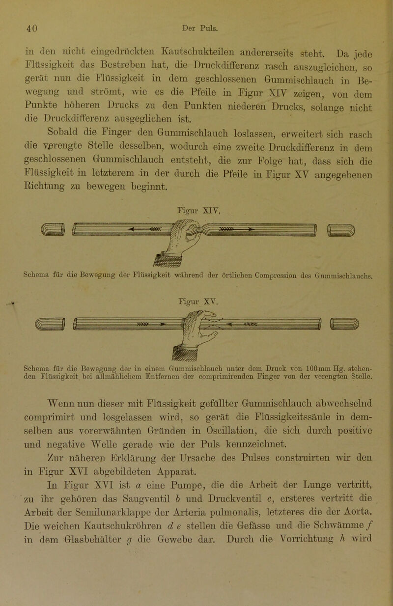 in den nicht eingedrückten Kautschukteilen andererseits steht. Da jede Flüssigkeit das Bestreben hat, die Druckdifferenz rasch auszugleichen, so gerät nun die Flüssigkeit in dem geschlossenen Gummischlauch in Be- wegung und strömt, wie es die Pfeile in Figur XIY zeigen, von dem Punkte höheren Drucks zu den Punkten niederen Drucks, solange nicht die Druckdifferenz ausgeglichen ist. Sobald die Finger den Gummischlauch loslassen, erweitert sich rasch die verengte Stelle desselben, wodurch eine zweite Druckdifferenz in dem geschlossenen Gummischlauch entsteht, die zur Folge hat, dass sich die Flüssigkeit in letzterem in der durch die Pfeile in Figur XV angegebenen Richtung zu bewegen beginnt. Figur XIV. Schema für die Bewegung der Flüssigkeit während der örtlichen Compression des Gummischlauchs. Figur XV. Schema für die Bewegung der in einem Gummischlauch unter dem Druck von 100mm Hg. stehen- den Flüssigkeit, bei allmählichem Entfernen der comprimirenden Finger von der verengten Stelle. Wenn nun dieser mit Flüssigkeit gefüllter Gummischlauch abwechselnd comprimirt und losgelassen wird, so gerät die Flüssigkeitssäule in dem- selben aus vorerwähnten Gründen in Oscillation, die sich durch positive und negative Welle gerade wie der Puls kennzeichnet. Zur näheren Erklärung der Ursache des Pulses construirten wir den in Figur XYI abgebildeten Apparat. In Figur XYI ist a eine Pumpe, die die Arbeit der Lunge vertritt, zu ihr gehören das Säugventil b und Druckventil c, ersteres vertritt die Arbeit der Semilunarklappe der Arteria pulmonalis, letzteres die der Aorta. Die weichen Kautschukröhren d e stellen die Gefässe und die Schwämme / in dem Glasbehälter g die Gewebe dar. Durch die Vorrichtung h wird