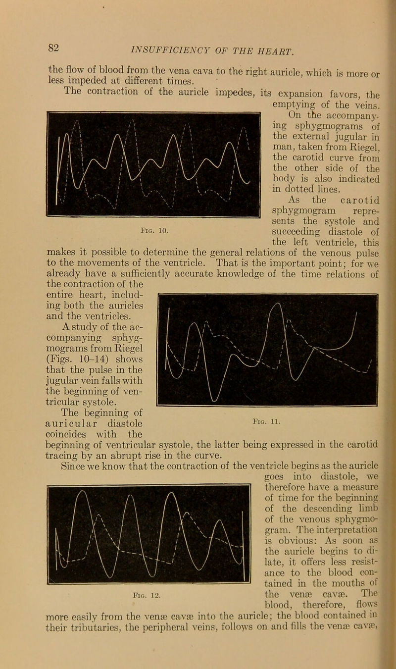 the flow of blood from the vena cava to the right auricle, which is more or less impeded at different times. The contraction of the auricle impedes, its expansion favors, the emptying of the veins. On the accompany- ing sphygmograms of the external jugular in man, taken from Riegel, the carotid curve from the other side of the body is also indicated in dotted lines. As the carotid sphygmogram repre- sents the systole and Fig- 10- succeeding diastole of the left ventricle, this makes it possible to determine the general relations of the venous pulse to the movements of the ventricle. That is the important point; for we already have a sufficiently accurate knowledge of the time relations of the contraction of the entire heart, includ- ing both the auricles and the ventricles. A study of the ac- companying sphyg- mograms from Riegel (Figs. 10-14) shows that the pulse in the jugular vein falls with the beginning of ven- tricular systole. The beginning of auricular diastole Fig- u- coincides with the beginning of ventricular systole, the latter being expressed in the carotid tracing by an abrupt rise in the curve. Since we know that the contraction of the ventricle begins as the auricle goes into diastole, we therefore have a measure of time for the beginning of the descending limb of the venous sphygmo- gram. The interpretation is obvious: As soon as the auricle begins to di- late, it offers less resist- ance to the blood con- tained in the mouths of Fig. 12. the venae cavae. The blood, therefore, flows more easily from the venae cavae into the auricle; the blood contained in their tributaries, the peripheral veins, follows on and fills the venae cavae,