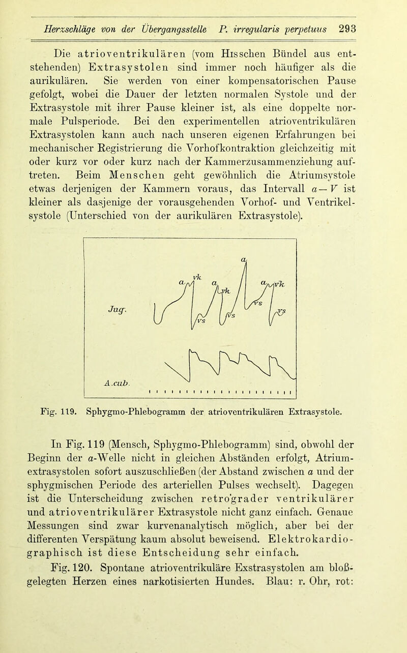Die atrioventrikulären (vom Hissclien Bündel aus ent- stehenden) Extrasystolen sind immer noch häufiger als die aurikulären. Sie werden von einer kompensatorischen Pause gefolgt, wobei die Dauer der letzten normalen Systole und der Extrasystole mit ihrer Pause kleiner ist, als eine doppelte nor- male Pulsperiode. Bei den experimentellen atrioventrikulären Extrasystolen kann auch nach unseren eigenen Erfahrungen hei mechanischer Registrierung die Vorhofkontraktion gleichzeitig mit oder kurz vor oder kurz nach der Kammerzusammenziehung auf- treten. Beim Menschen geht gewöhnlich die Atriumsystole etwas derjenigen der Kammern voraus, das Intervall a—V ist kleiner als dasjenige der vorausgehenden Vorhof- und Ventrikel- systole (Unterschied von der aurikulären Extrasystole). Fig. 119. Sphygmo-Phlebogramm der atrioventrikulären Extrasystole. In Fig. 119 (Mensch, Sphygmo-Phlehogramm) sind, obwohl der Beginn der a-Welle nicht in gleichen Abständen erfolgt, Atrium- extrasystolen sofort auszuschließen (der Abstand zwischen a und der sphygmischen Periode des arteriellen Pulses wechselt). Dagegen ist die Unterscheidung zwischen retrograder ventrikulärer und atrioventrikulärer Extrasystole nicht ganz einfach. Genaue Messungen sind zwar kurvenanalytisch möglich, aber bei der differenten Verspätung kaum absolut beweisend. Elektrokardio- graphisch ist diese Entscheidung sehr einfach. Fig. 120. Spontane atrioventrikuläre Exstrasystolen am bloß- gelegten Herzen eines narkotisierten Hundes. Blau: r. Ohr, rot;