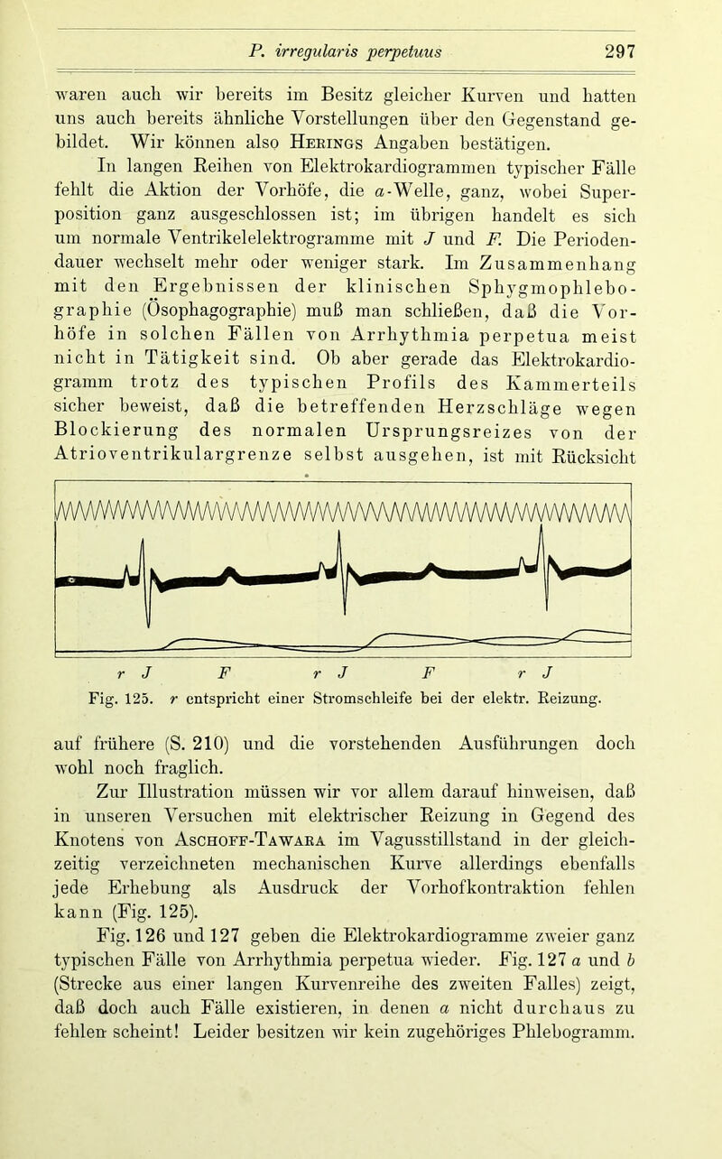 waren auch wir bereits im Besitz gleicher Kurven und hatten uns auch bereits ähnliche Vorstellungen über den Gegenstand ge- bildet. Wir können also Herings Angaben bestätigen. In langen Reihen von Elektrokardiogrammen typischer Fälle fehlt die Aktion der Vorhöfe, die a-Welle, ganz, wobei Super- position ganz ausgeschlossen ist; im übrigen handelt es sich um normale Ventrikelelektrogramme mit J und F. Die Perioden- dauer wechselt mehr oder weniger stark. Im Zusammenhang mit den Ergebnissen der klinischen Sphygmophlebo- graphie (Osophagographie) muß man schließen, daß die Vor- höfe in solchen Fällen von Arrhythmia perpetua meist nicht in Tätigkeit sind. Ob aber gerade das Elektrokardio- gramm trotz des typischen Profils des Kammerteils sicher beweist, daß die betreffenden Herzschläge wegen Blockierung des normalen ürsprungsreizes von der Atrioventrikulargrenze selbst ausgehen, ist mit Rücksicht r J F r J F r J Fig. 125. r entspricht einer Stromschleife hei der elektr. Reizung. auf frühere (S. 210) und die vorstehenden Ausführungen doch wohl noch fraglich. Zur Illustration müssen wir vor allem darauf hinweisen, daß in unseren Versuchen mit elektrischer Reizung in Gegend des Knotens von Aschofe-Tawaea im Vagusstillstand in der gleich- zeitig verzeichneten mechanischen Kurve allerdings ebenfalls jede Erhebung als Ausdruck der Vorhof kontraktion fehlen kann (Fig. 125). Fig. 126 und 127 geben die Elektrokardiogramme zweier ganz typischen Fälle von Arrhythmia perpetua wieder. Fig. 127 a und b (Strecke aus einer langen Kurvenreihe des zweiten Falles) zeigt, daß doch auch Fälle existieren, in denen a nicht durchaus zu fehlen scheint! Leider besitzen vir kein zugehöriges Phlebogramm.