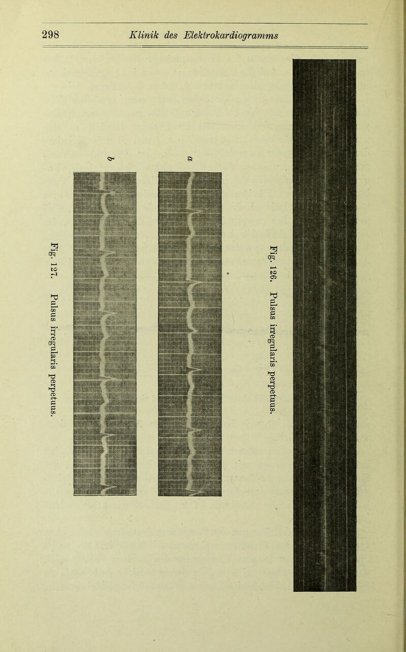 Fig. 127. Pulsus iiTegularis perpetuus.
