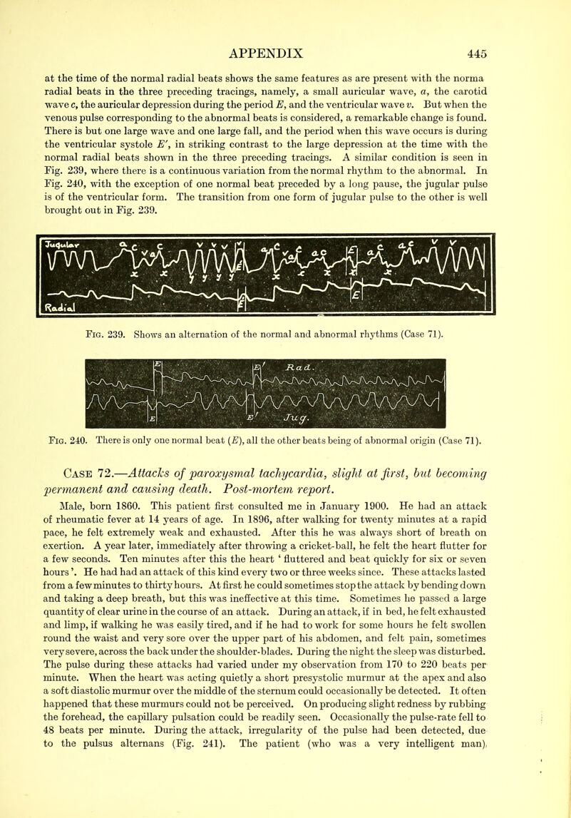 at the time of the normal radial beats shows the same features as are present with the norma radial beats in the three preceding tracings, namely, a small auricular wave, a, the carotid wave c, the auricular depression during the period E, and the ventricular wave v. But when the venous pulse corresponding to the abnormal beats is considered, a remarkable change is found. There is but one large wave and one large fall, and the period when this wave occurs is during the ventricular systole E', in striking contrast to the large depression at the time with the normal radial beats shown in the three preceding tracings. A similar condition is seen in Fig. 239, where there is a continuous variation from the normal rhythm to the abnormal. In Fig. 240, with the exception of one normal beat preceded by a long pause, the jugular pulse is of the ventricular form. The transition from one form of jugular pulse to the other is well brought out in Fig. 239. Fig. 239. Shows an alternation of the normal and abnormal rhythms (Case 71). Fig. 240. There is only one normal beat (E), all the other beats being of abnormal origin (Case 71). Case 72.—Attacks of paroxysmal tachycardia, slight at first, but becoming permanent and causing death. Post-mortem report. Male, born 1860. This patient first consulted me in January 1900. He had an attack of rheumatic fever at 14 years of age. In 1896, after walking for twenty minutes at a rapid pace, he felt extremely weak and exhausted. After this he was always short of breath on exertion. A year later, immediately after throwing a cricket-ball, he felt the heart flutter for a few seconds. Ten minutes after this the heart ‘ fluttered and beat quickly for six or seven hours ’. He had had an attack of this kind every two or three weeks since. These attacks lasted from a few minutes to thirty hours. At first he could sometimes stop the attack by bending down and taking a deep breath, but this was ineffective at this time. Sometimes he passed a large quantity of clear urine in the course of an attack. During an attack, if in bed, he felt exhausted and limp, if walking he was easily tired, and if he had to work for some hours he felt swollen round the waist and very sore over the upper part of his abdomen, and felt pain, sometimes very severe, across the back under the shoulder-blades. During the night the sleep was disturbed. The pulse during these attacks had varied under my observation from 170 to 220 beats per minute. When the heart was acting quietly a short presystolic murmur at the apex and also a soft diastolic murmur over the middle of the sternum could occasionally be detected. It often happened that these murmurs could not be perceived. On producing slight redness by rubbing the forehead, the capillary pulsation could be readily seen. Occasionally the pulse-rate fell to 48 beats per minute. During the attack, irregularity of the pulse had been detected, due to the pulsus alternans (Fig. 241). The patient (who was a very intelligent man),