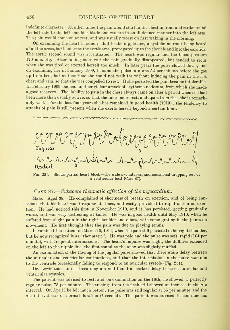 indefinite character. At other times the pain would start in the chest in front and strike round the left side to the left shoulder-blade and radiate in an ill-defined manner into the left arm. The pain would come on at rest, and was usually worst on first waking in the morning. On examining the heart I found it dull to the nipple line, a systolic murmur being heard at all the areas, but loudest at the aortic area, propagated up to the clavicle and into the carotids. The aortic second sound was accentuated. The heart was regular and the blood-pressure 170 mm. Hg. After taking more rest the pain gradually disappeared, but tended to recur when she was tired or exerted herself too much. In later years the pulse slowed down, and on examining her in January 1909, I found the pulse-rate was 52 per minute before she got up from bed, but at that time she could not walk far without inducing the pain in the left chest and arm, so that she was compelled to rest. If she persisted the pain became intolerable. In February 1909 she had another violent attack of erythema nodosum, from which she made a good recovery. The liability to pain in the chest always came on after a period when she had been more than usually active, so that she takes more rest, and apart from this, she is remark- ably well. For the last four years she has remained in good health (1913); the tendency to attacks of pain is still present when she exerts herself beyond a certain limit. Fig. 251. Shows partial heart-block—the wide o-c interval and occasional dropping out of a ventricular beat (Case 87). Case 87.—Subacute rheumatic affection of the myocardium. Male. Aged 38. He complained of shortness of breath on exertion, and of being con- scious that his heart was irregular at times, and easily provoked to rapid action on exer- tion. He had noticed this first in November 1910, and it has persisted, getting gradually worse, and was very distressing at times. He was in good health until May 1910, when he suffered from slight pain in the right shoulder and elbow, with some grating in the joints on movement. He first thought that the pain was due to playing tennis. I examined the patient on March 15,1911, when the pain still persisted in his right shoulder, but he now recognized it as ‘ rheumatic ’. He was pale and the pulse was soft, rapid (104 per minute), with frequent intermissions. The heart’s impulse was slight, the dullness extended on the left to the nipple fine, the first sound at the apex was slightly muffled. An examination of the tracing of the jugular pulse showed that there was a delay between the auricular and ventricular contractions, and that the intermission in the pulse was due to the ventricle occasionally failing to respond to an auricular systole (Fig. 251). Dr. Lewis took an electrocardiogram and found a marked delay between auricular and ventricular systoles. The patient was advised to rest, and on examination on the 18th, he showed a perfectly regular pulse, 75 per minute. The tracings from the neck still showed an increase in the o-c interval. On April 1 he felt much better; the pulse was still regular at 65 per minute, and the a-c interval was of normal duration (J second). The patient was advised to continue his