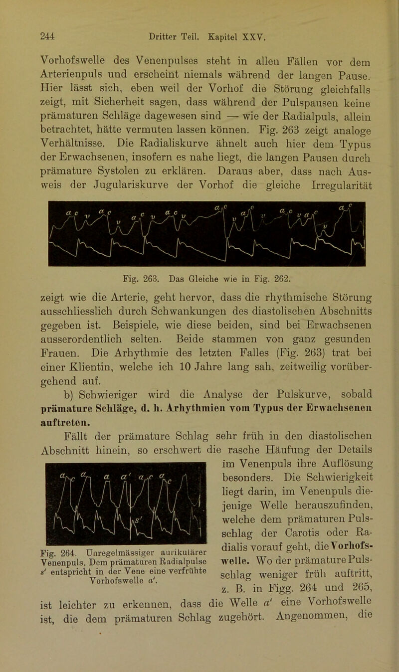 Vorhofswelle des Venenpulses steht in allen Fällen vor dem Arterienpuls und erscheint niemals während der langen Pause. Hier lässt sich, eben weil der Vorhof die Störung gleichfalls zeigt, mit Sicherheit sagen, dass während der Pulspausen keine prämaturen Schläge dagewesen sind — wie der Radialpuls, allein betrachtet, hätte vermuten lassen können. Fig. 263 zeigt analoge Verhältnisse. Die Radialiskurve ähnelt auch hier dem Typus der Erwachsenen, insofern es nahe liegt, die langen Pausen durch prämature Systolen zu erklären. Daraus aber, dass nach Aus- weis der Jugulariskurve der Vorhof die gleiche Irregularität Fig. 263. Das Gleiche wie in Fig. 262. zeigt wie die Arterie, geht hervor, dass die rhythmische Störung ausschliesslich durch Schwankungen des diastolischen Abschnitts gegeben ist. Beispiele, wie diese beiden, sind bei Erwachsenen ausserordentlich selten. Beide stammen von ganz gesunden Frauen. Die Arhythmie des letzten Falles (Fig. 263) trat bei einer Klientin, welche ich 10 Jahre lang sah, zeitweilig vorüber- gehend auf. b) Schwieriger wird die Analyse der Pulskurve, sobald prämature Schläge, <1. li. Arhythmien vom Typus (1er Erwachsenen auf treten. Fällt der prämature Schlag sehr früh in den diastolischen Abschnitt hinein, so erschwert die rasche Häufung der Details im Venenpuls ihre Auflösung besonders. Die Schwierigkeit liegt darin, im Venenpuls die- jenige Welle herauszufinden, welche dem prämaturen Puls- schlag der Carotis oder Ra- dialis vorauf geht, d^ orhofs- welle. Wo der prämature Puls- schlag weniger früh auftritt, z. ß. in Figg. 264 und 265, ist leichter zu erkennen, dass die Welle a‘ eine Vorhofswelle ist, die dem prämaturen Schlag zugehört. Angenommeu, die Fig. 264. Unregelmässiger aurikulärer Venenpuls. Dem prämaturen Radialpulse s' entspricht in der Vene eine verfrühte Vorhofswelle a‘.