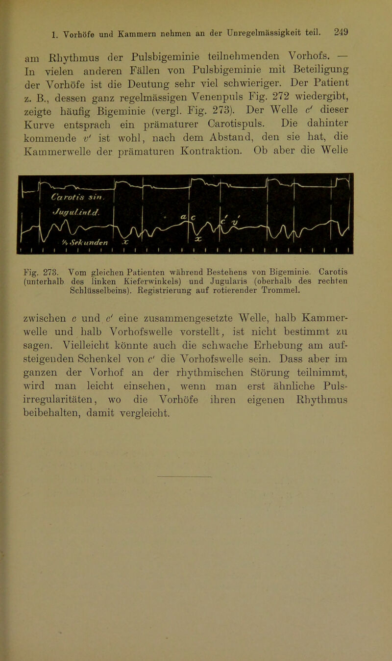am Rhythmus der Pulsbigeminie teilnehmenden Vorhofs. — In vielen anderen Fällen von Pulsbigeminie mit Beteiligung der Vorhöfe ist die Deutung sehr viel schwieriger. Der Patient z. B., dessen ganz regelmässigen Venenpuls Fig. 272 wiedergibt, zeigte häufig Bigemiuie (vergl. Fig. 273). Der Welle & dieser Kurve entsprach ein prämaturer Carotispuls. Die dahinter kommende v‘ ist wohl, nach dem Abstand, den sie hat, die Kammerwelle der prämaturen Kontraktion. Ob aber die Welle Fig. 278. Vom gleichen Patienten während Bestehens von Bigeminie. Carotis (unterhalb des linken Kieferwinkels) und Jugularis (oberhalb des rechten Schlüsselbeins). Registrierung auf rotierender Trommel. zwischen c und e' eine zusammengesetzte Welle, halb Kammer- welle und halb Vorbofswelle vorstellt, ist nicht bestimmt zu sagen. Vielleicht könnte auch die schwache Erhebung am auf- steigenden Schenkel von c‘ die Vorhofswelle sein. Dass aber im ganzen der Vorhof an der rhythmischen Störung teilnimmt, wird man leicht einsehen, wenn man erst ähnliche Puls- irregularitäten, wo die Vorhöfe ihren eigenen Rhythmus beibehalten, damit vergleicht.