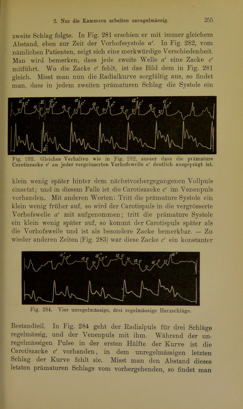 zweite Schlag folgte. In Fig. 281 erschien er mit immer gleichem Abstand, eben zur Zeit der Vorhofssystole a'. In Fig. 282, vom nämlichen Patienten, zeigt sich eine merkwürdige Verschiedenheit. Man wird bemerken, dass jede zweite Welle cd eine Zacke d mitführt. Wo die Zacke d fehlt, ist das Bild dem in Fig. 281 gleich. Misst man nun die Radialkurve sorgfältig aus, so findet man, dass in jedem zweiten prämaturen Schlag die Systole ein Fig. 283. Gleiches Verhalten wie in Fig. 282, ausser dass die prämature Carotiszacke c‘ an jeder vergrösserten Vorhofswelle a‘ deutlich ausgeprägt ist. klein wenig später hinter dem näcbstvorhergegangenen Vollpuls einsetzt; und in diesem Falle ist die Carotiszacke d im Venenpuls vorhanden. Mit anderen Worten: Tritt die prämature Systole ein klein wenig früher auf, so wird der Carotispuls in die vergrösserte Vorhofswelle a‘ mit aufgenommen; tritt die prämature Systole ein klein wenig später auf, so kommt der Carotispuls später als die Vorhofswelle und ist als besondere Zacke bemerkbar. — Zu wieder anderen Zeiten (Fig. 283) war diese Zacke d ein konstanter Fig. 284. Vier unregelmässige, drei regelmässige Herzschläge. Bestandteil. In Fig. 284 geht der Radialpuls für drei Schläge regelmässig, und der Venenpuls mit ihm. Während der un- regelmässigen Pulse in der ersten Hälfte der Kurve ist die Carotiszacke d vorhanden, in dem unregelmässigen letzten Schlag der Kurve fehlt sie. Misst man den Abstand dieses letzten prämaturen Schlags vom vorhergehenden, so findet man