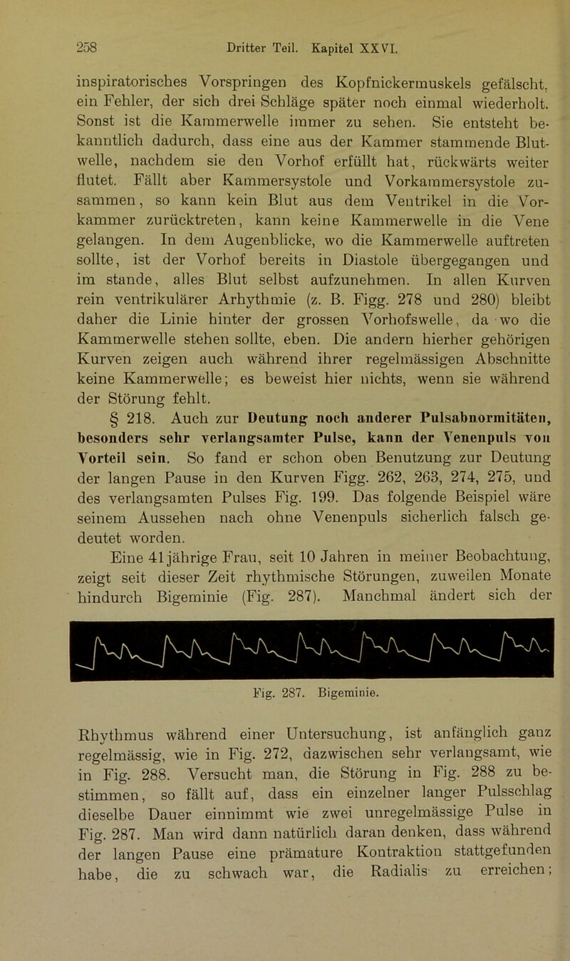inspiratorisches Vorspringen des Kopfnickermuskels gefälscht, ein Fehler, der sich drei Schläge später noch einmal wiederholt. Sonst ist die Kammerwelle immer zu sehen. Sie entsteht be- kanntlich dadurch, dass eine aus der Kammer stammende Blut- welle, nachdem sie den Vorhof erfüllt hat, rückwärts weiter flutet. Fällt aber Kammersystole und Vorkammersystole zu- sammen, so kann kein Blut aus dem Ventrikel in die Vor- kammer zurücktreten, kann keine Kammerwelle in die Vene gelangen. In dem Augenblicke, wo die Kammerwelle auftreten sollte, ist der Vorhof bereits in Diastole übergegangen und im stände, alles Blut selbst aufzunehmen. In allen Kurven rein ventrikulärer Arhythmie (z. B. Figg. 278 und 280) bleibt daher die Linie hinter der grossen Vorhofswelle, da wo die Kammerwelle stehen sollte, eben. Die andern hierher gehörigen Kurven zeigen auch während ihrer regelmässigen Abschnitte keine Kammerwelle; es beweist hier nichts, wenn sie während der Störung fehlt. § 218. Auch zur Deutung noch anderer Pulsabnormitäten, besonders sehr verlangsamter Pulse, kann der Venenpuls von Vorteil sein. So fand er schon oben Benutzung zur Deutung der langen Pause in den Kurven Figg. 262, 263, 274, 275, und des verlangsamten Pulses Fig. 199. Das folgende Beispiel wäre seinem Aussehen nach ohne Venenpuls sicherlich falsch ge- deutet worden. Eine 41jährige Frau, seit 10 Jahren in meiner Beobachtung, zeigt seit dieser Zeit rhythmische Störungen, zuweilen Monate hindurch Bigeminie (Fig. 287). Manchmal ändert sich der Fig. 287. Bigeminie. Rhythmus während einer Untersuchung, ist anfänglich ganz regelmässig, wie in Fig. 272, dazwischen sehr verlangsamt, wie in Fig. 288. Versucht man, die Störung in Fig. 288 zu be- stimmen, so fällt auf, dass ein einzelner langer Pulsschlag dieselbe Dauer einnimmt wie zwei unregelmässige Pulse in Fig. 287. Man wird dann natürlich daran denken, dass während der langen Pause eine prämature Kontraktion stattgefunden habe, die zu schwach war, die Radialis zu erreichen,