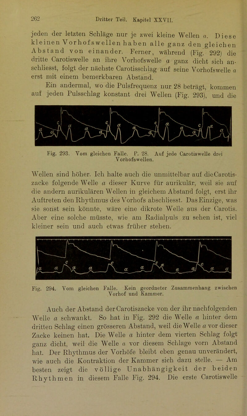 jeden der letzten Schläge nur je zwei kleine Wellen a. Diese kleinen Vorhofs wellen haben alle ganz den gleichen Abstand von einander. Ferner, während (Fig. 292) die dritte Carotiswelle an ihre Vorhofswelle a ganz dicht sich an- schliesst, folgt der nächste Carotisschlag auf seine Vorhofswelle a erst mit einem bemerkbaren Abstand. Ein andermal, wo die Pulsfrequenz nur 28 beträgt, kommen auf jeden Pulsschlag konstant drei Wellen (Fig. 293), und die Fig. 293. Vom gleichen Falle. P. 28. Auf jede Carotiswelle drei Vorhofswellen. Wellen sind höher. Ich halte auch die unmittelbar auf die Carotis- zacke folgende Welle a dieser Kurve für aurikulär, weil sie auf die andern aurikulären Wellen in gleichem Abstand folgt, erst ihr Auftreten den Rhythmus des Vorhofs abscbliesst. Das Einzige, was sie sonst sein könnte, wäre eine dikrote Welle aus der Carotis. Aber eine solche müsste, wie am Radialpuls zu sehen ist, viel kleiner sein und auch etwas früher stehen. Fig. 294. Vom gleichen Falle. Kein geordneter Zusammenhang zwischen Vorhof und Kammer. Auch der Abstand der Carotiszacke von der ihr nachfolgenden Welle a schwankt. So hat in Fig. 292 die Welle a hinter dem dritten Schlag einen grösseren Abstand, weil die Welle a vor dieser Zacke keinen hat. Die Welle a hinter dem vierten Schlag folgt ganz dicht, weil die Welle a vor diesem Schlage vorn Abstand hat. Der Rhythmus der Vorhöfe bleibt eben genau unverändert, wie auch die Kontraktion der Kammer sich dazu stelle. — Am besten zeigt die völlige Unabhängigkeit der beiden Rhythmen in diesem Falle Fig. 294. Die erste Carotiswelle