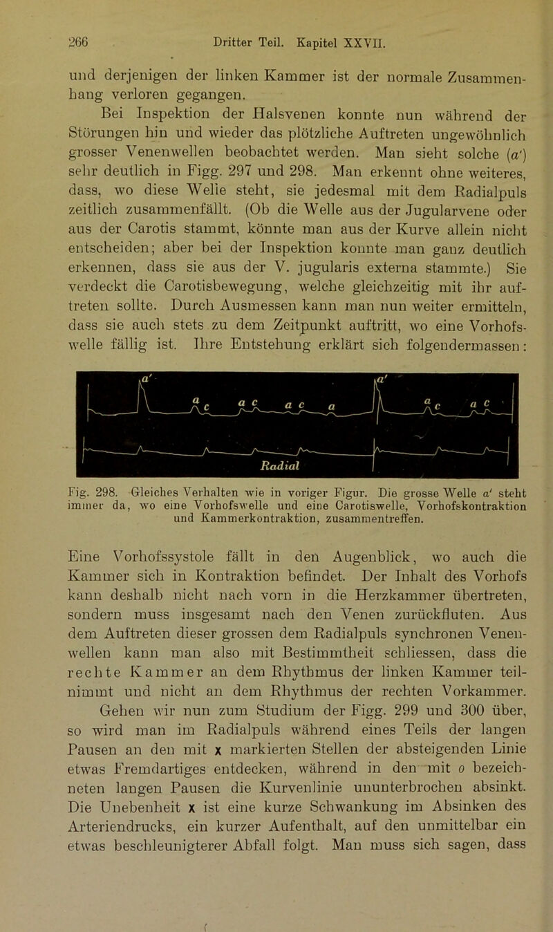 und derjenigen der linken Kammer ist der normale Zusammen- hang verloren gegangen. Bei Inspektion der Halsvenen konnte nun während der Störungen hin und wieder das plötzliche Auftreten ungewöhnlich grosser Venenwellen beobachtet werden. Man sieht solche («') sehr deutlich in Figg. 297 und 298. Man erkennt ohne weiteres, dass, wo diese Welle steht, sie jedesmal mit dem Radialpuls zeitlich zusammenfällt. (Ob die Welle aus der Jugularvene oder aus der Carotis stammt, könnte man aus der Kurve allein nicht entscheiden; aber bei der Inspektion konnte man ganz deutlich erkennen, dass sie aus der V. jugularis externa stammte.) Sie verdeckt die Carotisbewegung, welche gleichzeitig mit ihr auf- treten sollte. Durch Ausmessen kann man nun weiter ermitteln, dass sie auch stets zu dem Zeitpunkt auftritt, wo eine Vorhofs- welle fällig ist. Ihre Entstehung erklärt sich folgendermassen: Fig. 298. Gleiches Verhalten wie in voriger Figur. Die grosse Welle a‘ steht immer da, wo eine Vorhofswelle und eine Carotiswelle, Vorhofskontraktion und Kammerkontraktion, Zusammentreffen. Eine Vorhofssystole fällt in den Augenblick, wo auch die Kammer sich in Kontraktion befindet. Der Inhalt des Vorhofs kann deshalb nicht nach vorn in die Herzkammer übertreten, sondern muss insgesamt nach den Venen zurückfluten. Aus dem Auftreten dieser grossen dem Radialpuls synchronen Venen- wellen kann man also mit Bestimmtheit schliessen, dass die rechte Kammer an dem Rhythmus der linken Kammer teil- nimmt und nicht an dem Rhythmus der rechten Vorkammer. Gehen wir nun zum Studium der Figg. 299 und 300 über, so wird man im Radialpuls während eines Teils der langen Pausen an den mit x markierten Stellen der absteigenden Linie etwas Fremdartiges entdecken, während in den mit o bezeieh- neten langen Pausen die Kurvenlinie ununterbrochen absinkt. Die Unebenheit x ist eine kurze Schwankung im Absinken des Arteriendrucks, ein kurzer Aufenthalt, auf den unmittelbar ein etwas beschleunigterer Abfall folgt. Man muss sich sagen, dass