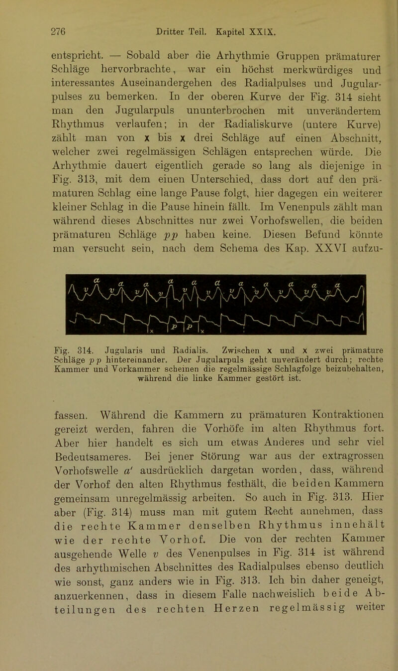 entspricht. — Sobald aber die Arhythmie Gruppen prämaturer Schläge hervorbrachte, war ein höchst merkwürdiges und interessantes Auseinandergehen des Radialpulses und Jugular- pulses zu bemerken. In der oberen Kurve der Fig. 314 sieht man den Jugularpuls ununterbrochen mit unverändertem Rhythmus verlaufen; in der Radialiskurve (untere Kurve) zählt man von x bis x drei Schläge auf einen Abschnitt, welcher zwei regelmässigen Schlägen entsprechen würde. Die Arhythmie dauert eigentlich gerade so lang als diejenige in Fig. 313, mit dem einen Unterschied, dass dort auf den prä- maturen Schlag eine lange Pause folgt, hier dagegen ein weiterer kleiner Schlag in die Pause hinein fällt. Im Venenpuls zählt man während dieses Abschnittes nur zwei Vorhofswellen, die beiden prämaturen Schläge pp haben keine. Diesen Befund könnte man versucht sein, nach dem Schema des Kap. XXVI aufzu- Fig. 314. Jugularis und Radialis. Zwischen x und x zwei prämature Schläge pp hintereinander. Der Jugularpuls geht unverändert durch; rechte Kammer und Vorkammer scheinen die regelmässige Schlagfolge beizubehalten, während die linke Kammer gestört ist. fassen. Während die Kammern zu prämaturen Kontraktionen gereizt werden, fahren die Vorhöfe im alten Rhythmus fort. Aber hier handelt es sich um etwas Anderes und sehr viel Bedeutsameres. Bei jener Störung war aus der extragrossen Vorhofswelle a' ausdrücklich dargetan worden, dass, während der Vorhof den alten Rhythmus festhält, die beiden Kammern gemeinsam unregelmässig arbeiten. So auch in Fig. 313. Hier aber (Fig. 314) muss man mit gutem Recht aunehmeu, dass die rechte Kammer denselben Rhythmus innehält wie der rechte Vorhof. Die von der rechten Kammer ausgehende Welle v des Venenpulses in Fig. 314 ist während des arhythmischen Abschnittes des Radialpulses ebenso deutlich wie sonst, ganz anders wie in Fig. 313. Ich bin daher geneigt, auzuerkennen, dass in diesem Falle nachweislich beide Ab- teilungen des rechten Herzen regelmässig weiter