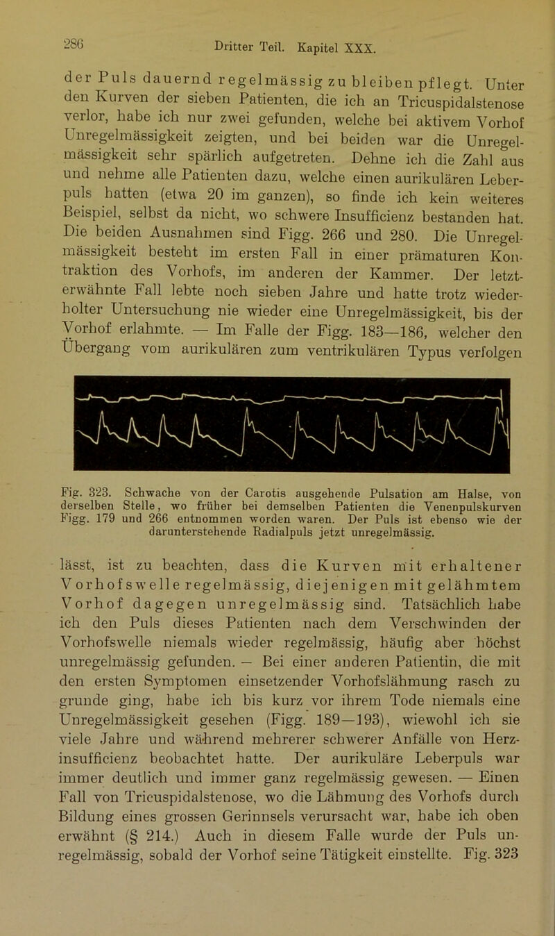28ü der Puls dauernd regelmässig zu bleiben pflegt. Unter den Kurven der sieben Patienten, die ich an Tricuspidalstenose verlor, habe ich nur zwei gefunden, welche bei aktivem Vorbof Unregelmässigkeit zeigten, und bei beiden war die Unregel- mässigkeit sehr spärlich aufgetreten. Dehne ich die Zahl aus und nehme alle Patienten dazu, welche einen aurikulären Leber- puls hatten (etwa 20 im ganzen), so finde ich kein weiteres Beispiel, selbst da nicht, wo schwere Insufficienz bestanden hat. Die beiden Ausnahmen sind Figg. 266 und 280. Die Unregel- mässigkeit besteht im ersten Fall in einer prämaturen Kon- traktion des Vorhofs, im anderen der Kammer. Der letzt- erwähnte Fall lebte noch sieben Jahre und hatte trotz wieder- holter Untersuchung nie wieder eine Unregelmässigkeit, bis der Vorhof erlahmte. — Im Falle der Figg. 183—186, welcher den Übergang vom aurikulären zum ventrikulären Typus verfolgen Fig. 323. Schwache von der Carotis ausgehende Pulsation am Halse, von derselben Stelle, wo früher bei demselben Patienten die Venenpulskurven Figg. 179 und 266 entnommen worden waren. Der Puls ist ebenso wie der darunterstehende Radialpuls jetzt unregelmässig. lässt, ist zu beachten, dass die Kurven mit erhaltener Vorhofswelle regelmässig, diejenigen mit gelähmtem Vorhof dagegen unregelmässig sind. Tatsächlich Labe ich den Puls dieses Patienten nach dem Verschwinden der Vorhofswelle niemals wieder regelmässig, häufig aber höchst unregelmässig gefunden. — Bei einer anderen Patientin, die mit den ersten Symptomen einsetzender Vorhofslähmung rasch zu gründe ging, habe ich bis kurz vor ihrem Tode niemals eine Unregelmässigkeit gesehen (Figg. 189 — 193), wiewohl ich sie viele Jahre und während mehrerer schwerer Anfälle von Herz- insufficienz beobachtet hatte. Der aurikuläre Leberpuls war immer deutlich und immer ganz regelmässig gewesen. — Einen Fall von Tricuspidalstenose, wo die Lähmung des Vorhofs durch Bildung eines grossen Gerinnsels verursacht war, habe ich oben erwähnt (§ 214.) Auch in diesem Falle wurde der Puls un- regelmässig, sobald der Vorhof seine Tätigkeit einstellte. Fig. 323