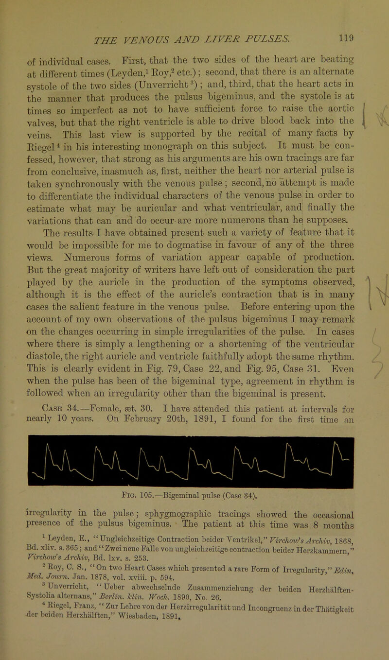 of iudividufil cfises. First, tlicit the two sides of the heart are beatings at different times (Leyden,i Eoy,^ etc.); second, that there is an alternate systole of the two sides (Unverricht«) ; and, third, that the heart acts in the manner that produces the pulsus bigeminus, and the systole is at tunes so imperfect as not to have sufficient force to raise the aortic valves, but that the right ventricle is able to drive blood back into the veins. This last view is supported by the recital of many facts by Eiegel ^ in his interesting monograph on this subject. It must be con- fessed, however, that strong as his arguments are his own tracings are far from conclusive, inasmuch as, first, neither the heart nor arterial pulse is taken synchronously with the venous pulse; second, no attempt is made to differentiate the individual characters of the venous pulse in order to estunate what may be auricular and what ventricular, and finally the variations that can and do occur are more numerous than he supposes. The results I have obtained present such a variety of feature that it would be impossible for me to dogmatise in favour of any of the three views. IsTumerous forms of variation appear capable of production. But the great majority of writers have left out of consideration the part played by the auricle in the production of the symptoms observed, although it is the effect of the auricle’s contraction that is in many cases the salient feature in the venous pulse. Before entering upon the account of my own observations of the pulsus bigeminus I may remark on the changes occurring in simple irregularities of the pulse. In cases where there is simply a lengthening or a shortening of the ventricular diastole, the right auricle and ventricle faithfully adopt the same rhythm. This is clearly evident in Fig. 79, Case 22, and Fig. 95, Case 31. Even when the pulse has been of the bigeminal type, agreement in rhythm is followed when an irregularity other than the bigeminal is present. Case 34.—Female, set. 30. I have attended this patient at intervals for nearly 10 years. On February 20th, 1891, I found for the first time an Fig. 105.—Bigeminal pulse (Case 34). irregularity in the pulse j sphygmographic tracings showed the occasional presence of the pulsus bigeminus. The patient at this time was 8 months ^ Leyden, E., “ Ungleichzeitige Conti-action beider Ventrikel,” Virchow’s Archiv, 1868, Bd. xliv. s. 365; and “ZweineueFalle von ungleichzeitige contraction beider Herzkammern,’ Virchoio’s Archiv, Bd. Ixv. s. 253. ■ Roy, C. S., “On two Heart Cases which presented a rare Form of Iiregularity,” Edin. Med. Jcnirn. Jan. 1878, vol. xviii. p. 594. * Unverricht, “ Ueber abwechselnde Zusammenziehung der beiden Herzhalften- Systolia alternans,” .ScrZm. hlin. Woch. 1890, No. 26. ■* Riegel, Franz, ‘ ‘ Zur Lehre von der Herzirregularitat und Incongruenz in der Thiitic-keit der beiden Herzhalften,” Wiesbaden, 1891, °