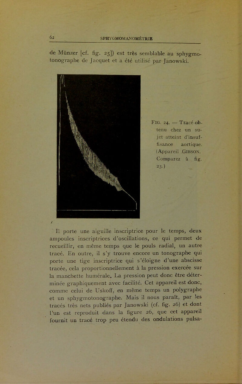 de Münzer [cf. fig. 25]) est très semblable au sphygmo- tonographe de Jacquet et a été utilisé par Janowski. ■ Fig. 24. — Tracé ob- tenu chez un su- jet atteint d’insuf- fisance aortique. (Appareil GlBSON. Comparez à fig. 2 3-) y Il porte une aiguille inscriptrice pour le temps, deux ampoules inscriptrices d’oscillations, ce qui permet de recueillir, en même temps que le pouls radial, un autre tracé. En outre, il s’y trouve encore un tonographe qui porte une tige inscriptrice qui s’éloigne d’une abscisse tracée, cela proportionnellement à la pression exercée sur la manchette humérale. La pression peut donc être déter- minée graphiquement avec facilité. Cet appareil est donc, comme celui de Uskoff, en même temps un polygraphe et un sphygmotonographe. Mais il nous paraît, par les tracés très nets publiés par Janowski (cf. fig. 26) et dont l’un est reproduit dans la figure 26, que cet appareil fournit un tracé trop peu étendu des ondulations puisa-