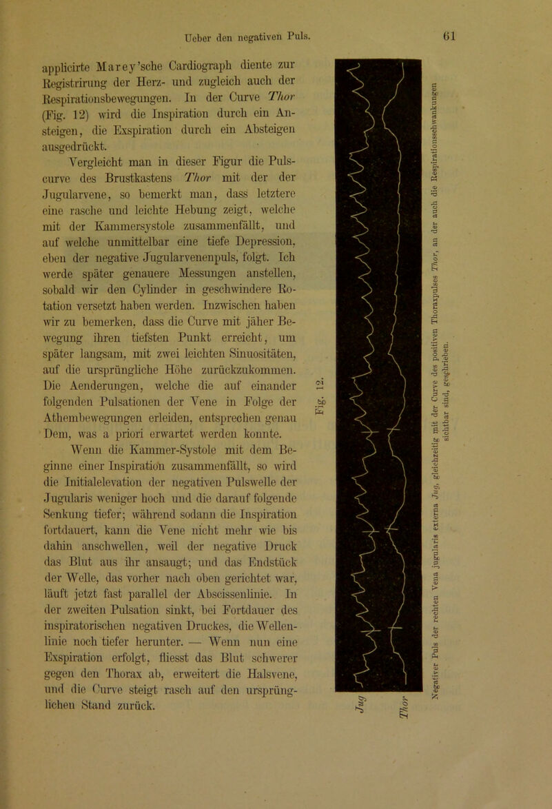 applicirte Marey’sche Cardiograpli diente zur Registrirung der Herz- und zugleich auch der Respirationsbewegungen. In der Curve Thor (Fig. 12) wird die Inspiration durch ein An- steigen, die Exspiration durch ein Absteigen ausgedrückt. Vergleicht man in dieser Figur die Puls- curve des Brustkastens Thor mit der der Jugularvene, so bemerkt man, dass letztere eine rasclie und leichte Hebung zeigt, welche mit der Kammersystole zusammenfällt, und auf welche unmittelbar eine tiefe Depression, eben der negative Jugularvenenpuls, folgt. Ich werde später genauere Messungen anstellen, sobald wir den Cyhnder in geschwindere Ro- tation versetzt haben werden. Inzwischen haben wir zu bemerken, dass die Curve mit jäher Be- wegung ikren tiefsten Punkt erreicht, um später langsam, mit zwei leichten Sinuositäten, auf die ursprüngüche Höhe zuiückzukommen. Die Aenderungen, welche die auf einander folgenden Pulsationen der Vene in Folge der Athemhewegungen erleiden, entsprechen genau Dem, was a priori erwartet werden konnte. Wenn die Kammer-Systole mit dem Be- ginne einer Inspiratiön zusammeufällt, so wird die Initialelevation der negativen Pulswelle der Jugularis weniger hoch und die darauf folgende Senkung tiefer; während sodann die Inspnation fortdauert, kann die Vene nicht mehr wie bis dahin anschweUen, weil der negative Druck das Blut aus ilir ansaugt; und das Endstück der Welle, das vorher nach oben gerichtet war, läuft jetzt fast parallel der Abscissenhnie. In der zweiten Pulsation sinkt, hei Fortdauer des inspiratorischen negativen Druckes, dieWeUeii- linie noch tiefer herunter. — Wenn nun eine Exspiration erfolgt, fliesst das Blut schwerer gegen den Thorax ab, erweitert die Halsvene, und die Cun'e steigt rasch auf den umprüng- lichen Stand zurück. Xegativer Puls der rechten Vena jugularis externa Jug, gleichzeitig mit der Curve des positiven Thoraxpulses Thor, an der auch die Respirationsschwankungen sichtbar sind, ge^hrieben.