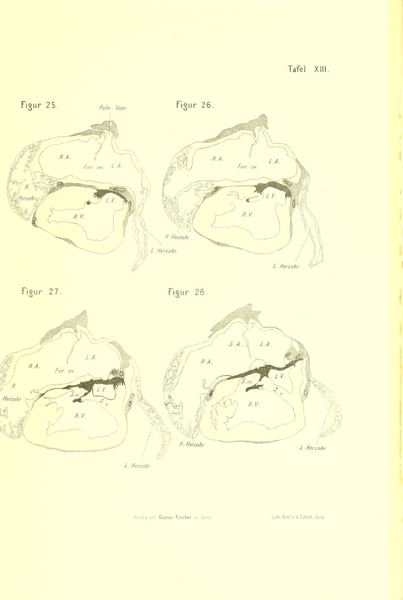 n^ur 25 Pulm. Vene Fi^ur 26. \ Fi^ur 27. Figur 28 L Herzohr