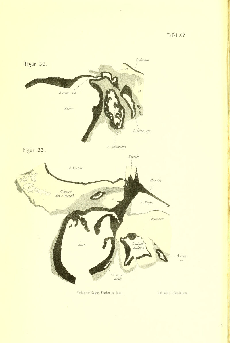 Fi^ur 32 Endocard Figur 33 A. coron. sin. Aorta A. puimonahs A. coron. sin 1 Septum A. coron. sin. ■; li