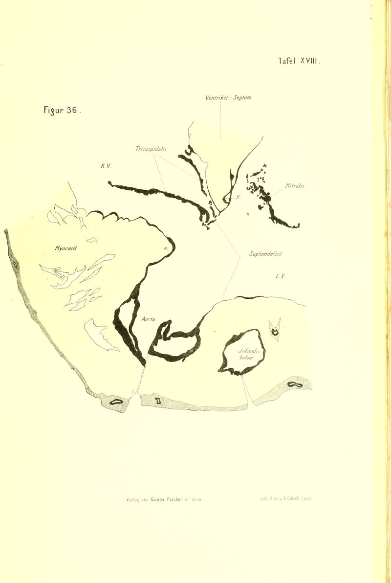 ■ i Verlag von Gustav Fischer in Jena Lilh. Audi v A Giltsch, Jena. Ventrikel - Septum Fi^ur 36 . I