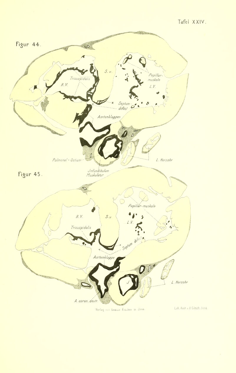 PdpiUar- muskeln icuspidalis Aorfenktappen Pulmonal - Osfium L . Herzohr Jnfun'dibulum Muskukfur , Papi Har-muskeln Tricuspidalis Aorienklappt L . Herzohr A. coron. dextr