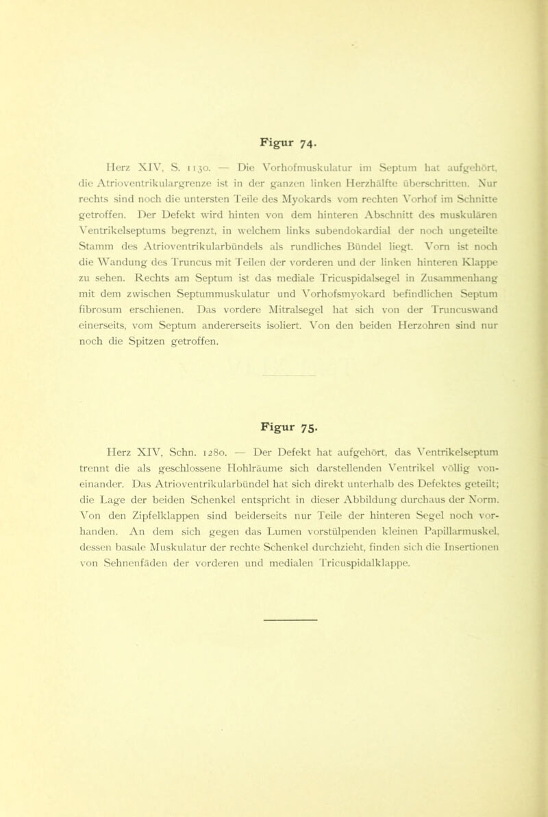 Herz XIV, S. 1130. — Die Vorhofmuskulatur im Septum hat aufg^ehört, die Atrioventrikularip'enze ist in der ganzen linken Herzhälfte überschritten. Nur rechts sind noch die untersten Teile des Myokards vom rechten \'orhof im Schnitte getroffen. Der Defekt wird hinten von dem hinteren Abschnitt des muskulären \’entrikelseptums begrenzt, in welchem links subendokardial der noch ungeteilte Stamm des Atrioventrikularbündels als rundliches Bündel liegt. Vorn ist noch die Wandung des Truncus mit Teilen der vorderen und der linken hinteren Klapp>e zu sehen. Rechts am Septum ist das mediale Tricuspidalsegel in Zusammenhang mit dem zwischen Septummuskulatur und \'orhofsmyokard befindlichen Septum fibrosum erschienen. Das vordere Mitralsegel hat sich von der Truncuswand einerseits, vom Septum andererseits isoliert. \'on den beiden Herzohren sind nur noch die Spitzen getroffen. Figur 75. Herz XIV, Schn. 1280. — Der Defekt hat aufgehört, das \>ntrikelseptum trennt die als geschlossene Hohlräume sich darstellenden N’^entrikel völlig von- einander. Das Atrioventrikularbündcl hat sich direkt unterhalb des Defektes geteilt; die Lage der beiden Schenkel entspricht in dieser Abbildung durchaus der Norm. \'on den Zipfelklappen sind beiderseits nur Teile der hinteren Segel noch vor- handen. An dem sich gegen das Lumen vorstülpenden kleinen Papillarmuskel, dessen basale Muskulatur der rechte Schenkel durchzieht, finden sich die Insertionen von Sehnenfäden der vorderen und medialen Tricuspidalklai>pe.