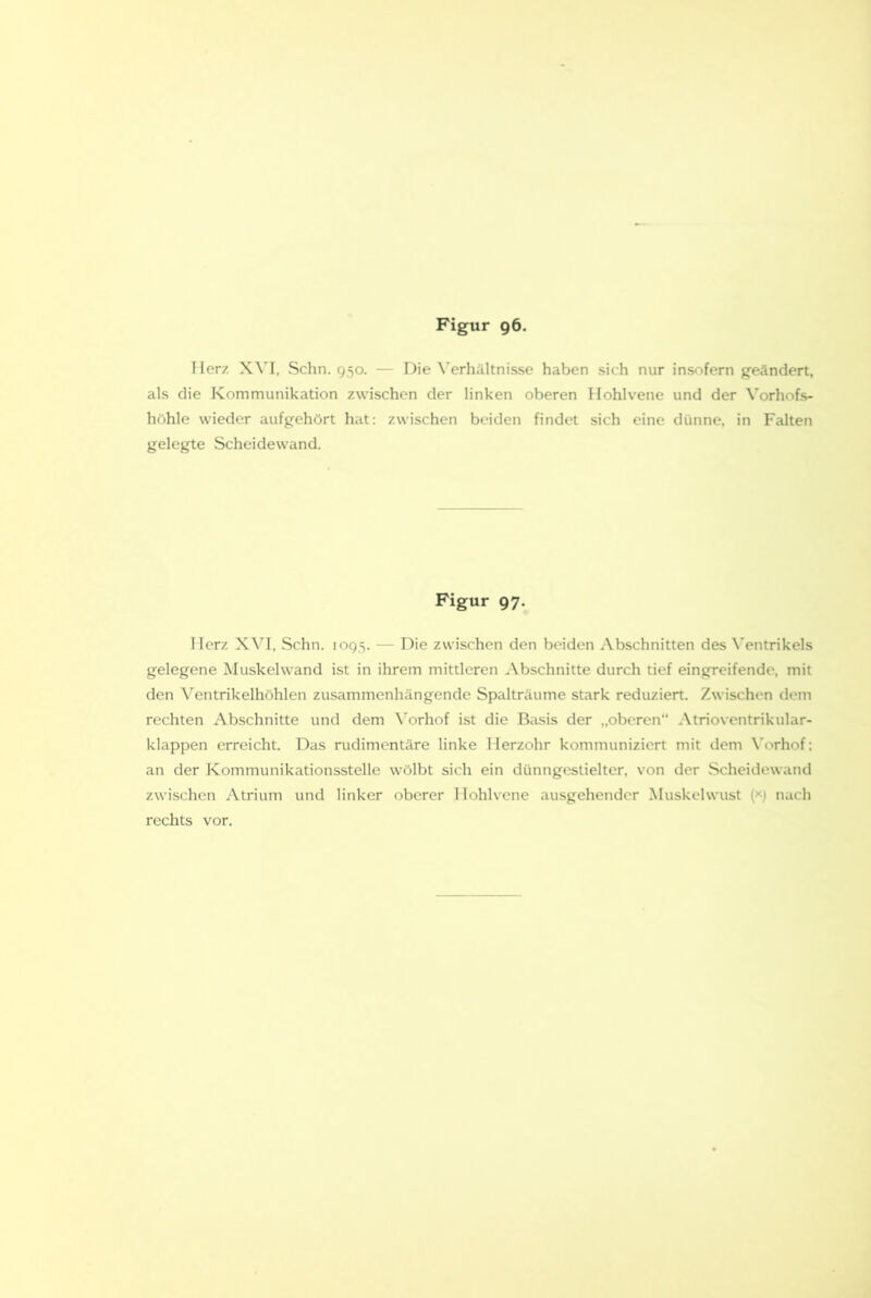 Herz X\'I, Schn. 950. — Die \'erhältnisse haben sich nur insofern geändert, als die Kommunikation zwischen der linken oberen klohlvene und der Vorhofs- höhle wieder aufgehört hat: zwischen beiden findet sich eine dünne, in Falten gelegte Scheidewand. Figur 97. Herz Schn. 1095. — Die zwischen den beiden Abschnitten des X'entrikels gelegene Muskelwand ist in ihrem mittleren Abschnitte durch tief eingreifende, mit den Ventrikelhöhlen zusammenhängende Spalträume stark reduziert. Zwischen dem rechten Abschnitte und dem \'orhof ist die Biisis der „oberen“ Atrioventrikular- klappen erreicht. Das rudimentäre linke Merzohr kommuniziert mit dem \'orhof; an der Kommunikationsstelle wölbt sich ein dünngestielter, von der Scheidewand zwischen Atrium und linker oberer llohlvene ausgehender Muskelwust (x) nach rechts vor.