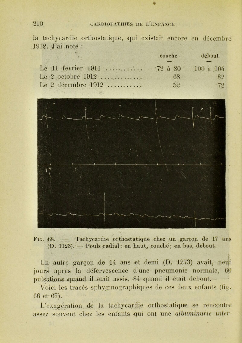 la tachycardie orlhoslalique, qui existait encore eii décembre 1912. J’ai noté : 1. • couché debout Le 11 février 1911 72 à 80 100' à 100 Le 2 octobre 1912 68 82 Le 2 décembre 1912 52 72 Fig. '68. — Tachycairdie orthostatique chez un garçon de 17 ans (D. 1123). — Pouls radial: en haut, couché; en bas, debout. Un autre garçon de 14 ans et demi (D. 1273) avait, neu|f jours' après la défervescence d’une pneumonie normale, 60 pulsations-jquand il était assis, 84 quand il était deliout. Voici les tracés s]3hygmogra[)hiques de ces deux enfants (lia. 66 et” 67). L’exagéralion, de la tachycardie oiiliostalhine se rencontre assez souvent chez les enfants qui ont nue albumimii ic Inlcr-