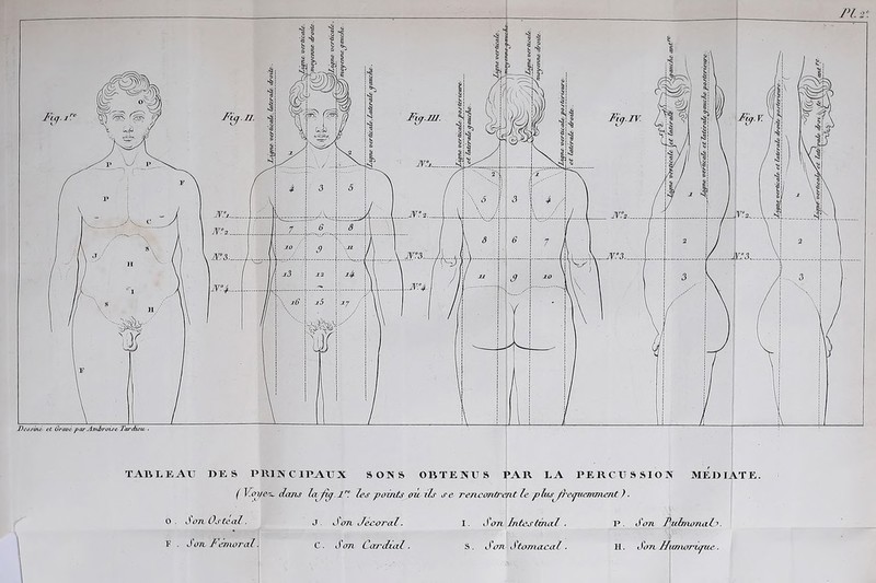 ( V.oye'L. dans la/iy.l les points où ils se rencontrent le plus fréquemment ) ■ o. SonOstéal. J. J on Jecoral. I. J on Intestinal . P. Son PnZmonaF F . Son Fémoral. C. Son Caj'dial. S. Son J tomacal. H. Son Uicmo7rupie.