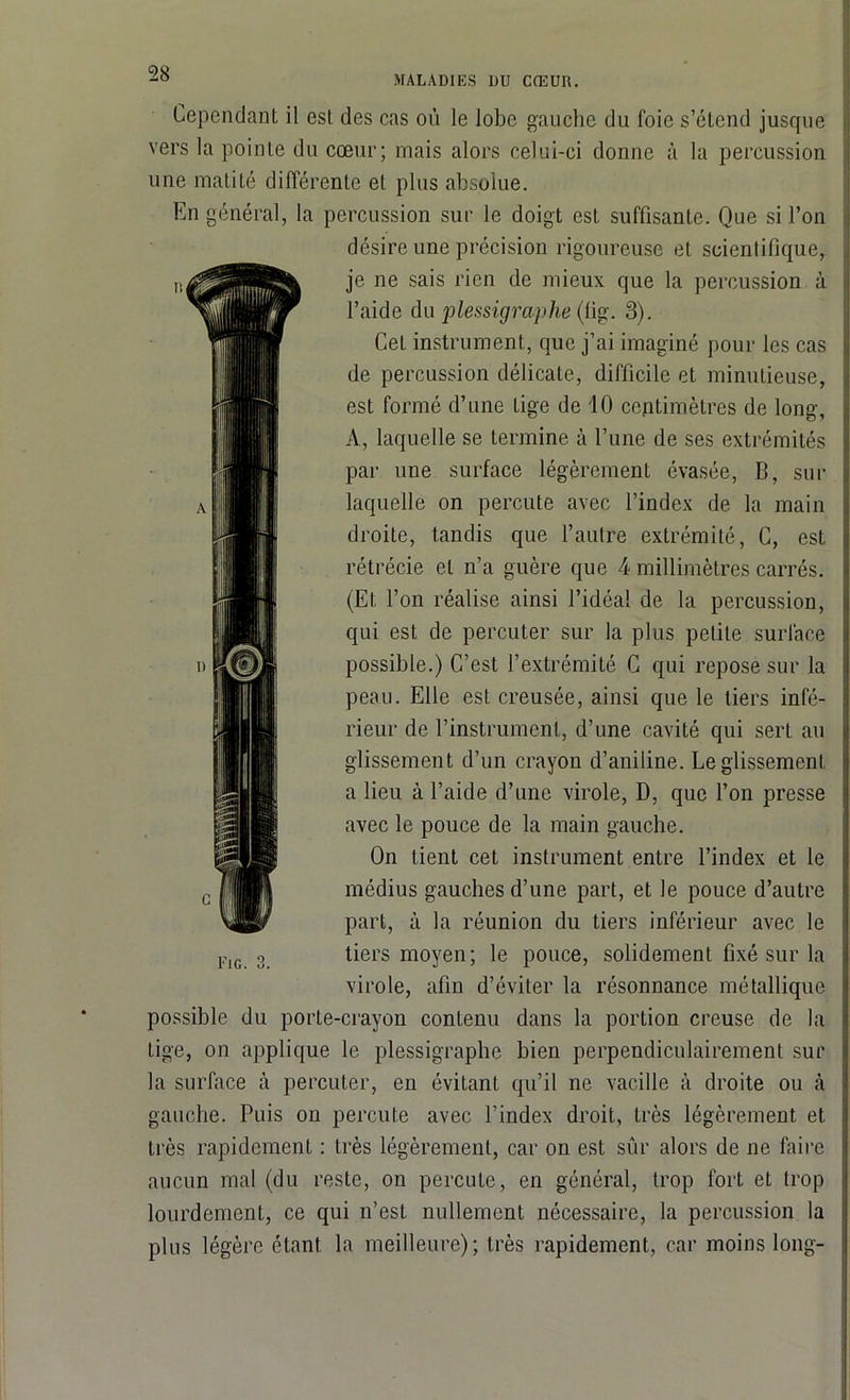 MALADIES I)U CŒUR. Cependant il est des cas où le lobe gauche du foie s’étend jusque vers la pointe du cœur; mais alors celui-ci donne à la percussion une matité différente et plus absolue. En général, la percussion sur le doigt est suffisante. Que si l’on désire une précision rigoureuse et scientifique, je ne sais rien de mieux que la percussion à l’aide du 'plessigrwphe (fig. 3). Cet instrument, que j’ai imaginé pour les cas de percussion délicate, difficile et minutieuse, est formé d’une tige de 10 centimètres de long, A, laquelle se termine à l’une de ses extrémités par une surface légèrement évasée, B, sur laquelle on percute avec l’index de la main droite, tandis que l’autre extrémité, C, est rétrécie et n’a guère que 4 millimètres carrés. (Et l’on réalise ainsi l’idéal de la percussion, qui est de percuter sur la plus petite surface possible.) C’est l’extrémité C qui repose sur la peau. Elle est creusée, ainsi que le tiers infé- rieur de l’instrument, d’une cavité qui sert au glissement d’un crayon d’aniline. Le glissement a lieu à l’aide d’une virole, D, que l’on presse avec le pouce de la main gauche. On tient cet instrument entre l’index et le médius gauches d’une part, et le pouce d’autre part, à la réunion du tiers inférieur avec le tiers moyen; le pouce, solidement fixé sur la virole, afin d’éviter la résonnance métallique possible du porte-crayon contenu dans la portion creuse de la tige, on applique le plessigraphe bien perpendiculairement sur la surface à percuter, en évitant qu’il ne vacille à droite ou à gauche. Puis ou percute avec l’index droit, très légèrement et très rapidement : très légèrement, car on est sûr alors de ne faire aucun mal (du reste, on percute, en général, trop fort et trop lourdement, ce qui n’est nullement nécessaire, la percussion la plus légère étant la meilleure); très rapidement, car moins long- Fig. 3.
