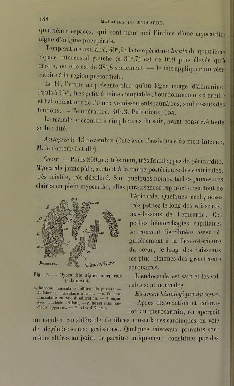 maladies du myocarde. quatrième espaces, qui sont pour moi l’indice d’une myocardite aigue d’origine puerpérale. Température axillaire, 40°,2 ; la température locale du quatrième espace intercostal gauche (à 39°,7) est de 0,9 plus élevée qu’à dioite, ou elle est de 38°,8 seulement. — Je fais appliquer un vési- catoire à la région précordiale. Le 11, l’urine ne présente plus qu’un léger nuage d’albumine. Pouls a 154, très petit, à peine comptable ; bourdonnements d’oreille et hallucinations de l’ouïe; vomissements jaunâtres, soubresauts des tendons. — Température, 40°,3. Pulsations, 154. La malade succombe à cinq heures du soir, ayant conservé toute sa lucidité. Autopsie le 13 novembre (faite avec l’assistance de mon interne, M. le docteur Letulie). Cœur. — Poids 300 gr.; très mou, très friable ; pas de péricardite. Myocarde jaune pâle, surtout à la partie postérieure des ventricules, très friable, très décoloré. Sur quelques points, taches jaunes très claires en plein myocarde; elles paraissent se rapprocher surtout de l’épicarde. Quelques ecchymoses très petites le long des vaisseaux, au-dessous de l’épicarde. Ces petites hémorrhagies capillaires se trouvent distribuées assez ré- gulièrement à la face extérieure du cœur, le long des vaisseaux les plus éloignés des gros troncs coronaires. L’endocarde est sain et les val- vules sont normales. Examen histologique du cœur. — Après dissociation et colora- tion au picrocarmin, on aperçoit un nombre considérable de libres musculaires cardiaques en voie de dégénérescence graisseuse. Quelques faisceaux primitifs sont même altérés au point de paraître uniquement constitués par des Fig. 9. — Myocardite aiguë puerpérale (éclampsie). a, faisceau musculaire infiltre de graisse. — b, faisceau musculaire normal. — c, faisceau musculaire en voie d’infiltration. — d, noyau avec nucléole brillant. — e, noyau sans nu- cléole apparent. — f, raies d’Eberth.