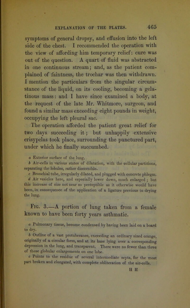 symptoms of general dropsy, and effusion into the left side of the chest. I recommended the operation with the view of affording him temporary relief: cure was out of the question. A quart of fluid was abstracted in one continuous stream; and, as the patient com- plained of faintness, the trochar was then withdrawn. I mention the particulars from the singular circum- stance of the liquid, on its cooling, becoming a gela- tinous mass: and I have since examined a body, at the request of the late Mr. Whitmore, surgeon, and found a similar mass exceeding eight pounds in weight, occupying the left pleural sac. The operation afforded the patient great relief for two days succeeding it; but unhappily extensive erisypelas took place, surrounding the punctured part, under which he finally succumbed. a Exterior surface of the lung. b Air-cells in various states of dilatation, with the cellular partitions, separating the lobules, rather discernible. c Bronchial tube, irregularly dilated, and plugged with concrete phlegm. d Air vesicles here, and especially lower down, much enlarged ; but this increase of size not near so perceptible as it otherwise would have been, in consequence of the application of a ligature previous to drying the lung. Fig. 3.—A portion of lung taken from a female known to have been forty years asthmatic. a Pulmonary tissue, become condensed by having been laid on a board to dry. b Outline of a vast protuberance, exceeding an ordinary sized orange, originally of a circular form, and at its base lying over a corresponding depression in the lung, and transparent. There were no fewer than three of these globular enlargements on one lobe. c Points to the residue of several intermediate septa, for the most part broken and elongated, with complete obliteration of the air-cells. H H