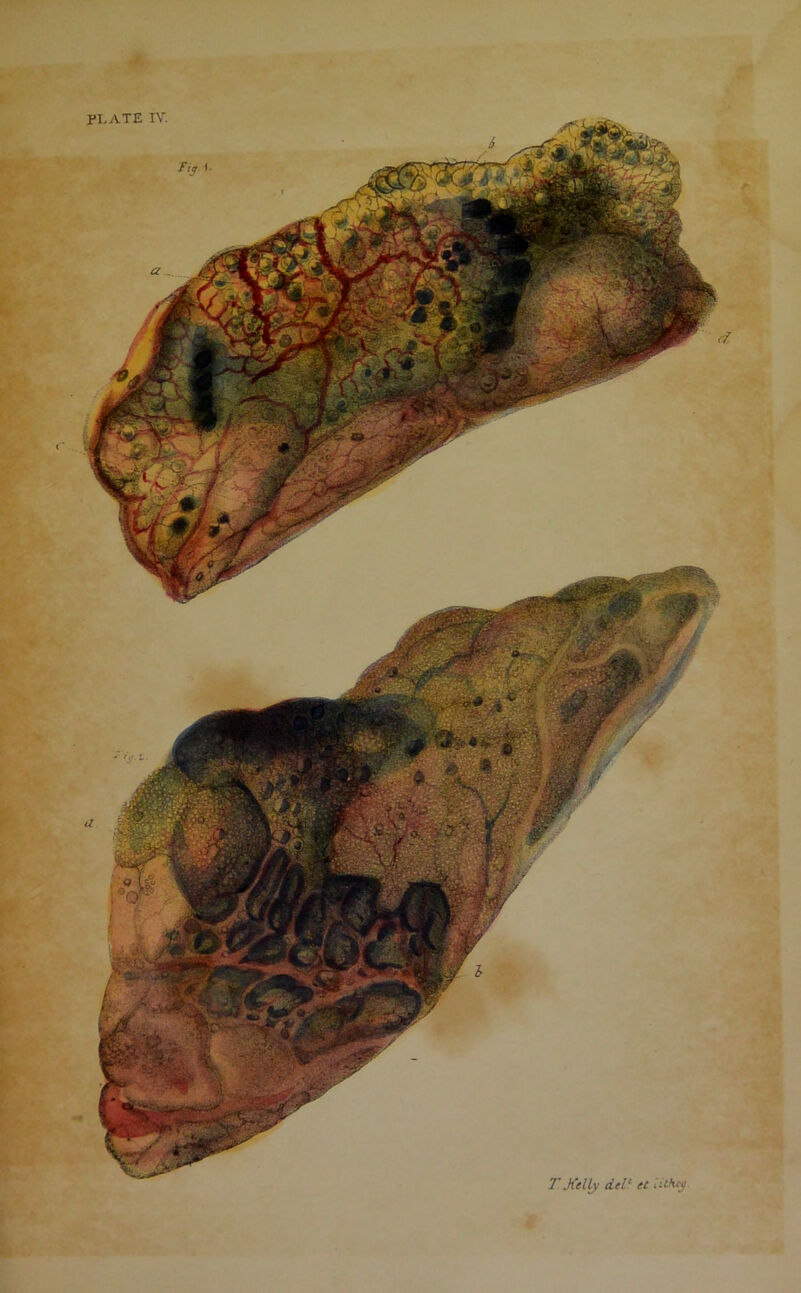 PLATE IV. T Jiclly del1 ec itthty