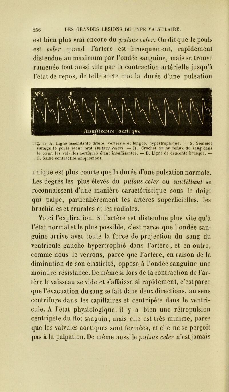 est bien plus vrai encore du pulsus celer. On dit que le pouls est celer quand l’artère est brusquement, rapidement distendue au maximum par l’ondée sanguine, mais se trouve ramenée tout aussi vite par la contraction artérielle jusqu’à l’état de repos, de telle sorte que la durée d’une pulsation Fig. 15. A, Ligne ascendante droite, verlicalc et longue, hypertrophique. — S. Sommet suraigu le pouls étant bref (pulsus celer). — R. Crochet du au reflux du sang dans le cœur, les valvules aortiques étant insuffisantes. — D. Ligne de descente brusque. — C. Sailie contractile uniquement. unique est plus courte que la durée d’une pulsation normale. Les degrés les plus élevés du pulsus celer ou sautillant se reconnaissent d’une manière caractéristique sous le doigt qui palpe, particulièrement les artères superficielles, les brachiales et crurales et les radiales. Voici l’explication. Si l’artère est distendue plus vite qu’à l’état normal et le plus possible, c’est parce que l’ondée san- guine arrive avec toute la force de projection du sang du ventricule gauche hypertrophié dans l’artère, et en outre, comme nous le verrons, parce que l’artère, en raison de la diminution de son élasticité, oppose à fondée sanguine une moindre résistance. De même si lors de la contraction de l’ar- tère le vaisseau se vide et s’affaisse si rapidement, c’est parce que l’évacuation du sang se fait dans deux directions, au sens centrifuge dans les capillaires et centripète dans le ventri- cule. A l’état physiologique, il y a bien une rétropulsion centripète du Ilot sanguin; mais elle est très minime, parce que les valvules aortiques sont fermées, et elle ne se perçoit pas à la palpation. De même aussi le pulsus celer n’est jamais