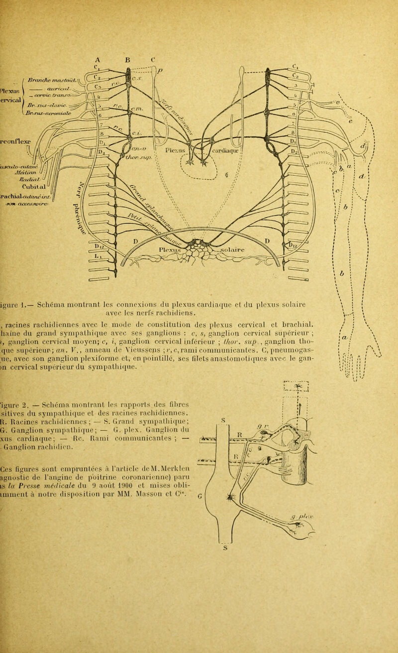 ABC igare 1.— Schéma montrant les connexions du plexus cardiaque et du plexus solaire avec les nerfs rachiiliens. , racines rachidiennes avec le mode de constitution des plexus cervical et brachial, luilne du grand sympathique avec ses ganglions : c, s, ganglion cervical supérieur ; I, ganglion cervical moyen; c, i, ganglion cervical inférieur ; l/ior. sup , ganglion Iho- que supérieur; rt«. V., anneau de Vieusscns ; r, c,rami communicantes. G, pneumogas- ue, avec son ganglion plexiformc et, en pointillé, ses filets anastoinoli([ues avec le gan- )n cervical supérieur du sympathiipie. ’igure 2. —Schéma monlranl les rapports des fibres silives du sympathique et des racines rachidiennes. II. Racines rachidiennes ; — S. Grand sympathi([ue; G. Ganglion sympathi((ue; — G. plex. Ganglion du xus cardiaque; — Ile. Kami communicantes ; — Ganglion rachidien. Ces figures sont empruntées à l'article dcM.McrkIen agnoslic de l’angine de poitrine coronarienne) paru is 1(1 Presse médicale du !) août 1900 et mises ofili- immcnt à notre disposition par MiM. Masson et G'.