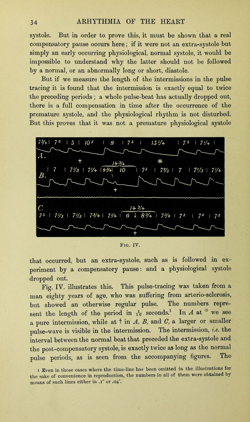 systole. But in order to prove this, it must be shown that a real compensatory pause occurs here; if it were not an extra-systole but simply an early occurring physiological, normal systole, it would be impossible to understand why the latter should not be followed by a normal, or an abnormally long or short, diastole. But if we measure the length of the intermissions in the pulse tracing it is found that the intermission is exactly equal to twice the preceding periods ; a whole pulse-beat has actually dropped out, there is a full compensation in time after the occurrence of the premature systole, and the physiological rhythm is not disturbed. But this proves that it was not a premature physiological systole C. 74- 3U 7s I l>/3 I 7>/3 I mi IVt f <3 l~ 83A '\ 73A I 73 I 7s I Is t Fig. IV. that occurred, but an extra-systole, such as is followed in ex- periment by a compensatory pause: and a physiological systole dropped out. Fig. IV. illustrates this. This pulse-tracing was taken from a man eighty years of age, who was suffering from arterio-sclerosis, but showed an otherwise regular pulse. The numbers repre- sent the length of the period in TV seconds.1 In A at * we see a pure intermission, while at t in A, B, and C, a larger or smaller pulse-wave is visible in the intermission. The intermission, i.e. the interval between the normal beat that preceded the extra-systole and the post-compensatory systole, is exactly twice as long as the normal pulse periods, as is seen from the accompanying figures. The i Even in those cases where the time-line has been omitted in the illustrations for the sake of convenience in reproduction, the numbers in all of them were obtained by means of such lines either in .i or .04.