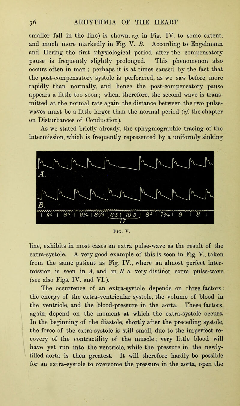 smaller fall in the line) is shown, e.g. in Fig. IY. to some extent, and much more markedly in Fig. V., B. According to Engelmann and Hering the first physiological period after the compensatory pause is frequently slightly prolonged. This phenomenon also occurs often in man ; perhaps it is at times caused by the fact that the post-compensatory systole is performed, as we saw before, more rapidly than normally, and hence the post-compensatory pause appears a little too soon; when, therefore, the second wave is trans- mitted at the normal rate again, the distance between the two pulse- waves must be a little larger than the normal period (cf. the chapter on Disturbances of Conduction). As we stated briefly already, the sphygmographic tracing of the intermission, which is frequently represented by a uniformly sinking Fig. V. line, exhibits in most cases an extra pulse-wave as the result of the extra-systole. A very good example of this is seen in Fig. V., taken from the same patient as Fig. IV., where an almost perfect inter- mission is seen in A, and in B a very distinct extra pulse-wave (see also Figs. IV. and VI.). The occurrence of an extra-systole depends on three factors: the energy of the extra-ventricular systole, the volume of blood in the ventricle, and the blood-pressure in the aorta. These factors, again, depend on the moment at which the extra-systole occurs. In the beginning of the diastole, shortly after the preceding systole, the force of the extra-systole is still small, due to the imperfect re- covery of the contractility of the muscle; very little blood will have yet run into the ventricle, while the pressure in the newly- filled aorta is then greatest. It will therefore hardly be possible for an extra-systole to overcome the pressure in the aorta, open the