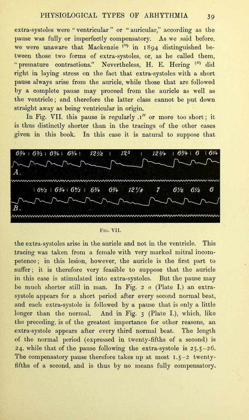 extra-systoles were “ ventricular ” or “ auricular,” according as the pause was fully or imperfectly compensatory. As we said before, we were unaware that Mackenzie (74) in 1894 distinguished be- tween those two forms of extra-systoles, or, as he called them, “ premature contractions.” Nevertheless, H. E. Hering (42) did right in laying stress on the fact that extra-systoles with a short pause always arise from the auricle, while those that are followed by a complete pause may proceed from the auricle as well as the ventricle; and therefore the latter class cannot be put down straight away as being ventricular in origin. In Fig. VII. this pause is regularly .1 or more too short; it is thus distinctly shorter than in the tracings of the other cases given in this book. In this case it is natural to suppose that 6A l 6% I 63A I 63A l 12V* \ n5 1 12V+ I 6V+ I 6 I 6A A. [v\ZV\A^A/\^/\^>y\^/\AAAAAAO/\/VXAAA/\AA/VVA-r\/v^/\/\AA/VV^ yVVVVVVXAA/VXA/VVVVVVWXrvnA/VVVVVNA/VVVVVAAnAA/VAfVAA/^^ Fig. VII. the extra-systoles arise in the auricle and not in the ventricle. This tracing was taken from a female with very marked mitral incom- petence ; in this lesion, however, the auricle is the first part to suffer; it is therefore very feasible to suppose that the auricle in this case is stimulated into extra-systoles. But the pause may be much shorter still in man. In Fig. 2 a (Plate I.) an extra- systole appears for a short period after every second normal beat, and each extra-systole is followed by a pause that is only a little longer than the normal. And in Fig. 3 (Plate I.), which, like the preceding, is of the greatest importance for other reasons, an extra-systole appears after every third normal beat. The length of the normal period (expressed in twenty-fifths of a second) is 24, while that of the pause following the extra-systole is 25.5-26. The compensatory pause therefore takes up at most 1.5-2 twenty- fifths of a second, and is thus by no means fully compensatory.