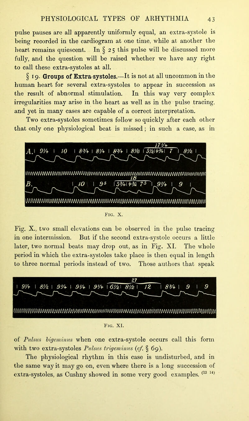 pulse pauses are all apparently uniformly equal, an extra-systole is being recorded in the cardiogram at one time, while at another the heart remains quiescent. In § 25 this pulse will be discussed more fully, and the question will be raised whether we have any right to call these extra-systoles at all. § 19. Groups of Extra-systoles.—It is not at all uncommon in the human heart for several extra-systoles to appear in succession as the result of abnormal stimulation. In this way very complex irregularities may arise in the heart as well as in the pulse tracing, and yet in many cases are capable of a correct interpretation. Two extra-systoles sometimes follow so quickly after each other that only one physiological beat is missed; in such a case, as in A. I 9jA I W I 83A I 8A I 83A I 8V& I 5&\M\ 7 I 8!fz I WvWVMM/MM/WWWWW^^ 13 B. I iO I 9s 153A\ H-3A 73 \9JA I 9 I \aaaa/\aaaaaamaamaa/v\aaaaaaaa<a\/iaaaaaaaaaaaaaaaa/v\/v\maaaaaaa/iaaaaaaa/\a/iaaaaa/i/iaaaaa/( Fig. X., two small elevations can be observed in the pulse tracing in one intermission. But if the second extra-systole occurs a little later, two normal beats may drop out, as in Fig. XI. The whole period in which the extra-systoles take place is then equal in length to three normal periods instead of two. Those authors that speak 27 I 9]A I 8Vz I 97A I 9]A I 97A I 6Vz\ 8tf>\ 1Z I 83A I 9 I 9 MmrnmMmmimMmmrnmmiMmwmmmiwmmMmMm Fig. XI. of Pulsus bigeminus when one extra-systole occurs call this form with two extra-systoles Pulsus trigeminus (cf. § 69). The physiological rhythm in this case is undisturbed, and in the same way it may go on, even where there is a long succession of extra-systoles, as Cushny showed in some very good examples. (13 14)