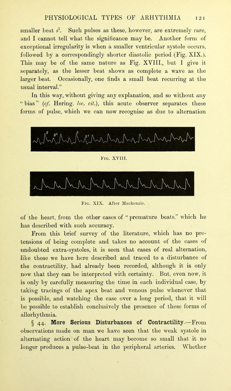smaller beat s1. Such, pulses as these, however, are extremely rare, and I cannot tell what the significance may be. Another form of exceptional irregularity is when a smaller ventricular systole occurs, followed by a correspondingly shorter diastolic period (Fig. XIX.). This may be of the same nature as Fig. XVIII., but I give it separately, as the lesser beat shows as complete a wave as the larger beat. Occasionally, one finds a small beat recurring at the usual interval.” In this way, without giving any explanation, and so without any “ bias ” (cf. Hering, loc. cit.), this acute observer separates these forms of pulse, which we can now recognise as due to alternation Fig. XIX. After Mackenzie. of the heart, from the other cases of “ premature beats,” which he has described with such accuracy. From this brief survey of the literature, which has no pre- tensions of being complete and takes no account of the cases of undoubted extra-systoles, it is seen that cases of real alternation, like those we have here described and traced to a disturbance of the contractility, had already been recorded, although it is only now that they can be interpreted with certainty. But, even now, it is only by carefully measuring the time in each individual case, by taking tracings of the apex beat and venous pulse whenever that is possible, and watching the case over a long period, that it will be possible to establish conclusively the presence of these forms of allorhythmia. | 44. More Serious Disturbances of Contractility.—From observations made on man we have seen that the weak systole in alternating action of the heart may become so small that it no longer produces a pulse-beat in the peripheral arteries. Whether