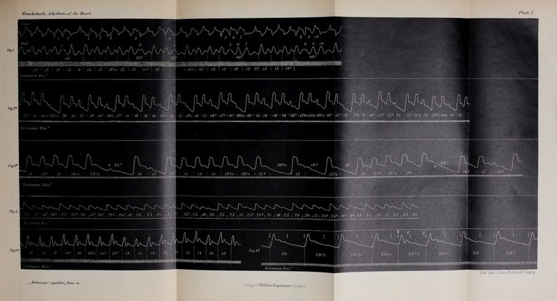 Wenckebach, Arhythnna o/‘ the Heart. Lith Aust. Julius Klmkhardt Leipzig mmxmm Zeitmnss: 0,O¥. Ve 1 /-/- I 15*/*. 1 IS1/', 1 15.3 I 15 1 15-/3 I i5 1 ioPct \ AU 1 ,\VMWMYrtYWYVVWrYiY/AW/VWViVWYWYWrYWMVAW/AVWMWVVYWYAYViYWV\W 'Ad (mass: 0,o 0 Xeiimass' signifies r Time in  Ysrlag vonYVillielm Enjjelniaini itiL-ipzig