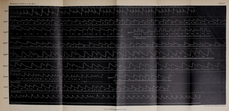 Figlti Fig.m Fiff.ni Fig.m Fig.lSi Fig. IS. £ Fig. IS. 4 Fig.ISS. Fig. IS! Verkg von/Willielm Enj| etmaim m L eip zig -vnry-\r -VTTVVTrvnrv^ Xcifnmss: 0, Tftwwivyiffi Zeitmas.s: O, <> *. riiim itymmiTn nrr nnvi i7mnn'imtnm ijinmimmnir; tinTiiiiiTimmimTimmi'niimiiT ,:rttmnirniTnnT»inm'mwiiiRt! Z.citm ash 0,0 ,5 I I'h 27,5 WYWVVj'YWWVYyYYYVY <’V\YlYVkVY»WvYYVWYV\ ! 16 Vo I r.wyww.wmvvYfYYVvYVVYvv< 28 mVr\^YAYY^r\7^YyrmYYi 28 I (YVYYVVYVYW^'YW'(Ylrt\WYVYV| 16,5 i V.. i > i • Y .Y.vrrrWNym-ivrvvjY, \VAYvYWv^YAY(N|.W,Y^>YAYAYA'AV.NWA-mYmYiVYVYY'> iwrrrrmiWrtYWirr YiYf lYYYYWr.YY ( 0, 0 4. f/YYYYYWYYW\ VYVYWYYYi ,Y AYvYVY <Y fYY/VYYVYi ymmwj'fUfw .'l l .Y.Y.Yr (YrYVYY •YwYiYYfYYYYYYm -?.9 j /£'/♦ I OOYYVYY OfYYftYYVYYOYYYWVV 'I'l Yi'iYAY Yi 'j /7% I rT rtWA ViVrrtYMVYYYYf |. /7$i .y: fOA r lYlYl'iYYYlYYil YlYlYAWAiYl-. 17 [ f AYY’YiY YlYftYflfljWYY < fflYrtYrY lYl 27'Vi MYWrYfOViVf(YvYlWYi'lY f AVYiYYVYYYYYVYYYyIYYY^ AYi r/*i lYYYY'iY »YYlYYYy.. i'flYffffYYtY YfflrnYY'iYT niYiYi YOYAYYYAYAYAYVYAWYVYAfi' ^VVVYYVVYYYVYYYrnnrrtVYYYYYVVVVVVVW'/VYYVYVYY>YYVVYYVVVYV*VYVViflOfYYWfAYYY'l'j ff ftYYfYOYTYYWrfftYf YiYVY j imwivwvvvw.v'miwwiimvyv I'lii’miinmv rnmni nmwm|rrrrfTiTiirmmmwi| jvi'i’iYi-irirrYiYi'A'iYiVirfij -ij'.imrm'nTmnmi jirn)n-i)tiirA}mirrmriri'n rrrrminnniiYrrri hmww Zct/rnaas:d, 0//. Tiirnirmnn!' WiiiiliinljiffliftnilliiTOTOniKirc^ n A t\_ r^L, J — 22,5 39 22,S ffl,5 1 yNf\^x /\^/\ X /\ 27s/a 25'A j 16,5 28 Vo j 17 J \ I'l mmi ill i iiiii ffliniraimniiiiiiiiimii iiin 1 l ! i i/k_ /K | 27,6 23,s 16 Vo «■ /6‘ i wwMmwwfwm /vywyyvyyyyvyvyyvvww yvyvmvyywi Ap\mwYm'iT|rvvY)>mimY|in /V IK K | 26 | 16 13,5 j 27 - y^YirwfmjiYrwriWffnYYffiTri w|ri I I’l i ! 1 l /V K A 76 r> 16 i 1 i i [ 1 1