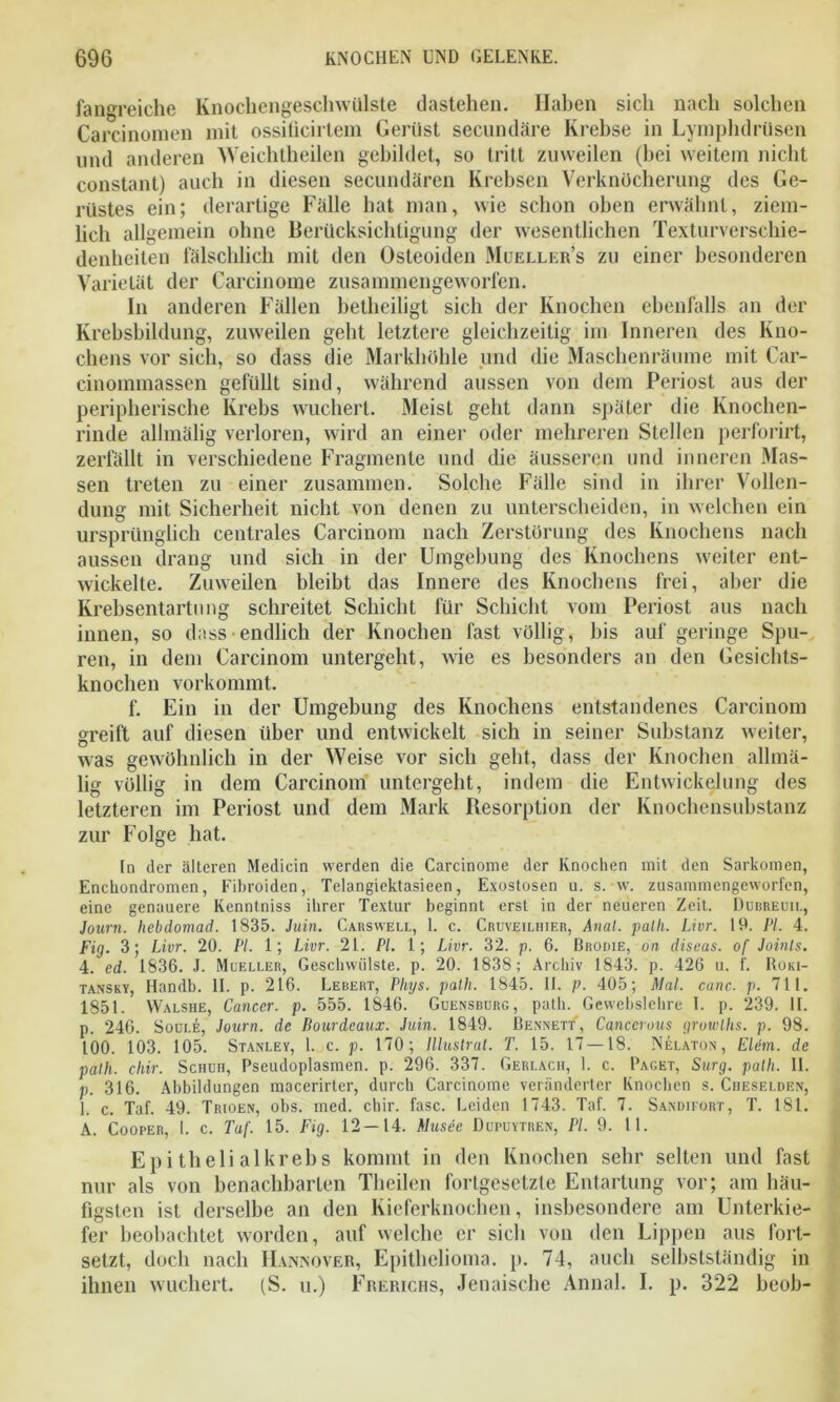 fangreiche Knochengeschwülste dastehen. Haben sich nach solchen Carcinomen mit ossificirtem Gerüst secundäre Krebse in Lymphdrüsen und anderen Weichtheilen gebildet, so tritt zuweilen (bei weitem nicht constant) auch in diesen secundären Krebsen Verknöcherung des Ge- rüstes ein; derartige Falle hat man, wie schon oben erwähnt, ziem- lich allgemein ohne Berücksichtigung der wesentlichen Texturverschie- denheiten fälschlich mit den Osteoiden Mueller’s zu einer besonderen Varietät der Carcinome zusammengeworfen. In anderen Fällen betheiligt sich der Knochen ebenfalls an der Krebsbildung, zuweilen gebt letztere gleichzeitig im Inneren des Kno- chens vor sich, so dass die Markhöhle und die Maschenräume mit Car- cinommassen gefüllt sind, während aussen von dem Periost aus der peripherische Krebs wuchert. Meist geht dann später die Knochen- rinde allmälig verloren, wird an einer oder mehreren Stellen perforirt, zerfällt in verschiedene Fragmente und die äusseren und inneren Mas- sen treten zu einer zusammen. Solche Fälle sind in ihrer Vollen- dung mit Sicherheit nicht von denen zu unterscheiden, in welchen ein ursprünglich centrales Carcinom nach Zerstörung des Knochens nach aussen drang und sich in der Umgebung des Knochens weiter ent- wickelte. Zuweilen bleibt das Innere des Knochens frei, aber die Krebsentartung schreitet Schicht für Schicht vom Periost aus nach innen, so dass endlich der Knochen fast völlig, bis auf geringe Spu- ren, in dem Carcinom untergeht, wie es besonders an den Gesichts- knocben vorkommt. f. Ein in der Umgebung des Knochens entstandenes Carcinom greift auf diesen über und entwickelt sich in seiner Substanz weiter, was gewöhnlich in der Weise vor sich geht, dass der Knochen allmä- lig völlig in dem Carcinom untergeht, indem die Entwickelung des letzteren im Periost und dem Mark Resorption der Knochensubstanz zur Folge hat. ln der älteren Medicin werden die Carcinome der Knochen mit den Sarkomen, Enchondromen, Fibroiden, Telangiektasieen, Exostosen u. s. w. zusammengeworfen, eine genauere Kenntniss ihrer Textur beginnt erst in der neueren Zeit. Dubreuil, Journ. hcbdomad. 1835. Juin. Carswell, 1. c. Cruveilhier, Anal. palh. Livr. 19. PI. 4. Fig. 3; Livr. 20. PI. 1; Livr. 21. PL 1; Livr. 32. p. 6. Brodie, on discas. of Joints. 4. cd. 1836. J. Mceller, Geschwülste, p. 20. 1838; Archiv 1843. p. 426 u. f. Roki- tansky, Handb. II. p. 216. Lebert, Phys. palh. 1845. II. p. 405; Mal. canc. p. 711. 1851. VValshe, Cancer, p. 555. 1846. Guensburg, patli. Gewebslehre I. p. 239. II. p. 246. Soui.e, Journ. de Bourdeaux. Juin. 1849. Bennett, Cancerous growlhs. p. 98. 100. 103. 105. Stanley, 1. c. p. 170; Illustrat. T. 15. 17 —18. Nelaton, Elcm. de palh. chir. Scuun, Pseudoplasmen, p. 296. 337. Gerlach, 1. c. Paget, Surg. palh. II. p. 316. Abbildungen macerirter, durch Carcinome veränderter Knochen s. Cheselden, 1. c. Taf. 49. Trioen, obs. med. chir. fase. Leiden 1743. Taf. 7. Sandifort, T. 181. A. Cooper, I. c. Taf. 15. Fig. 12 — 14. Musee Dupuytren, PI. 9. 11. Epithelial krebs kommt in den Knochen sehr selten und fast nur als von benachbarten Theilen fortgesetzte Entartung vor; am häu- figsten ist derselbe an den Kieferknochen, insbesondere am Unterkie- fer beobachtet worden, auf welche er sich von den Lippen aus fort- setzt, doch nach Hannover, Epithelioma, p. 74, auch selbstständig in ihnen wuchert. (S. u.) Frerichs, Jenaische Annal. I. p. 322 beob-