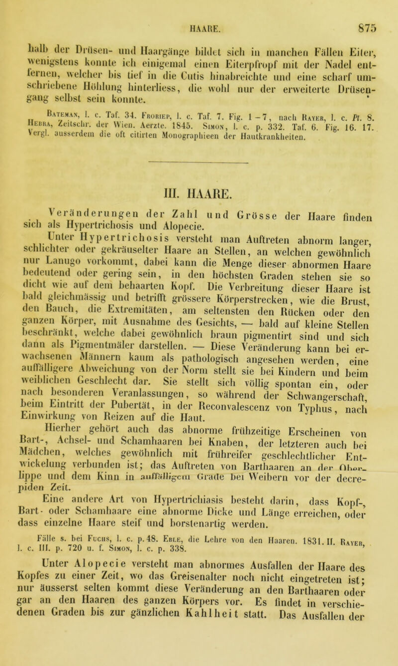 halb der Drüsen- und Haargänge bildet sich in manchen Fidlen Eiler, wenigstens konnte ich einigemal einen Eiterpfropf mit der Nadel ent- fernen, welcher bis tief in die Cutis hinabreichte und eine scharf um- schlichene Höhlung hinterliess, die wohl nur der erweiterte Drüsen- gang selbst sein konnte. Bateman I. c. Taf. 34. Froriep, I. c. Taf. 7. Fig. 1-7, nach Bayer, 1. c. Pt. 8. Hebra, Zeitsclir. der Wien. Aerzte. 1845. Simon, 1. c. p. 332. Tal. 6. Fig. 16. 17. Yergl. ausserdem die oft citirten Monographieen der Hautkrankheiten. III. HAARE. \ e i a n d e t u n ge n der Zahl und Grosse der Haare linden sich als Hypertrichosis und Alopecie. Unter Hypertrichosis versteht man Auftreten abnorm langer schlichter oder gekräuselter Haare an Stellen, an welchen gewohnficli nur Lanugo vorkommt, dabei kann die Menge dieser abnormen Haare bedeutend oder gering sein, in den höchsten Graden stehen sie so dicht wie auf dem behaarten Kopf. Die Verbreitung dieser Haare ist bald gleichmässig und betrifft grossere Körperstrecken, wie die Brust den Bauch, die Extremitäten, am seltensten den Bücken oder den ganzen Körper, mit Ausnahme des Gesichts, — bald auf kleine Stellen beschränkt, welche dabei gewöhnlich braun pigmentirt sind und sich dann als Pigmentmäler darstellen. — Diese Veränderung kann bei er- wachsenen Männern kaum als pathologisch angesehen werden eine auffälligere Abweichung von der Norm stellt sie bei Kindern und beim weiblichen Geschlecht dar. Sie stellt sich völlig spontan ein, oder nach besonderen Veranlassungen, so während der Schwan°-erschaft beim Eintritt der Pubertät, in der Beconvalescenz von Typhus nach Einwirkung von Beizen auf die Haut. Hierher gehört auch das abnorme frühzeitige Erscheinen von Bart-, Achsel- und Schamhaaren bei Knaben, der letzteren auch hei Mädchen, welches gewöhnlich mit frühreifer geschlechtlicher Ent- wickelung verbunden ist; das Auftreten von Barthaaren an dßr Oh*r_ lippc und dem Kinn in auffälligem Grade bei Weibern vor der decre- piden Zeit. Eine andere Art von Hypertrichiasis besteht darin, dass Kopf-, Bart- oder Schamhaare eine abnorme Dicke und Länge erreichen, oder dass einzelne Haare steif und borstenartig werden. Fülle s. bei Fuchs, 1. c. p.48. Erle, die Lehre von den Haaren. 1831 II Ryyfr 1. c. III. p. 720 u. f. Simon, I. c. p. 338. ' ‘ > Unter Alopecie versteht man abnormes Ausfallen der Haare des Kopfes zu einer Zeit, wo das Greisenalter noch nicht eingetreten ist* nur äusserst selten kommt diese Veränderung an den Barthaaren oder gar an den Haaren des ganzen Körpers vor. Es findet in verschie- denen Graden bis zur gänzlichen Kahlheit statt. Das Ausfallen der
