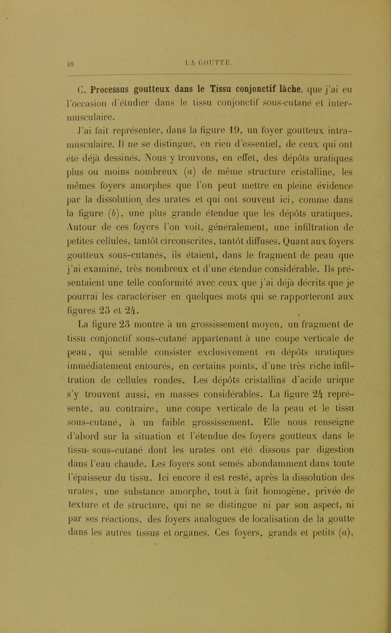 C. Processus goutteux dans le Tissu conjonctif lâche, que j’ai eu l’occasion d’éUiclier dans le tissu conjonclir sous-cutané et inter- musculaire. J’ai fait représenter, dans la figure .19, un foyer goutteux intra- musculaire. Il ne se distingue, en rien d’essentiel, de ceux (|ui ont été déjà dessinés. Nous y trouvons, en effet, des dépôts uraliques plus ou moins nombreux (a) de même structure cristalline, les mômes foyers amorphes que l’on peut mettre en pleine évidence par la dissolution des urates et qui ont souvent ici, comme dans la ligure (b), une plus grande étendue que les dépôts uraliques. Autour de ces foyers l’on voit, généralement, une infiltration de petites cellules, tantôt circonscrites, tantôt diffuses. Quant aux foyers goutteux sous-cutanés, ils étaient, dans le fragment de peau que j’ai examiné, très nombreux et d’une étendue considérable. Ils pré- sentaient une telle conformité avec ceux que j’ai déjà décrits que je pourrai les caractériser en quelques mots qui se rapporteront aux ligures 23 et 2^. La figure 23 montre à un grossissement moyen, un fragment de tissu conjonctif sous-cutané appartenant à une coupe verticale de peau, qui semble consister exclusivement en dépôts uratiques immédiatement entourés, en certains points, d’une très riche infil- tration de cellules rondes. Les dépôts cristallins d’acide urique s’y trouvent aussi, en masses considérables. La figure 24 repré- sente, au contraire, une coupe verticale de la peau et le tissu sous-cutané, à un faible grossissement. Elle nous renseigne d’abord sur la situation et l’étendue des foyers goutteux dans le tissu- sous-cutané dont les urates ont été dissous par digestion dans l’eau chaude. Les foyers sont semés abondamment dans toute l’épaisseur du tissu. Ici encore il est resté, après la dissolution des urates, une substance amorphe, tout à fait homogène, privée de texture et de structure, qui ne se distingue ni par son aspect, ni par ses réactions, des foyers analogues de localisation de la goutte dans les autres tissus et organes. Ces foyers, grands et pelils (a).
