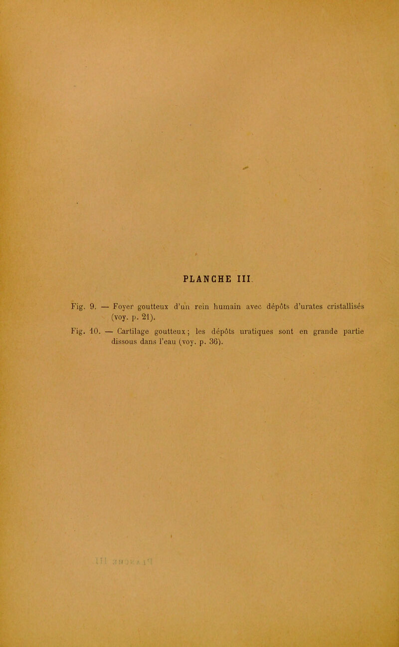 Fig. 9. — Foyer goutteux d’un rein humain avec dépôts d’urates cristallisés (voy. p. 21). Fig. 10. — Cartilage goutteux; les dépôts uratiques sont en grande partie dissous dans l’eau (voy. p. 36).