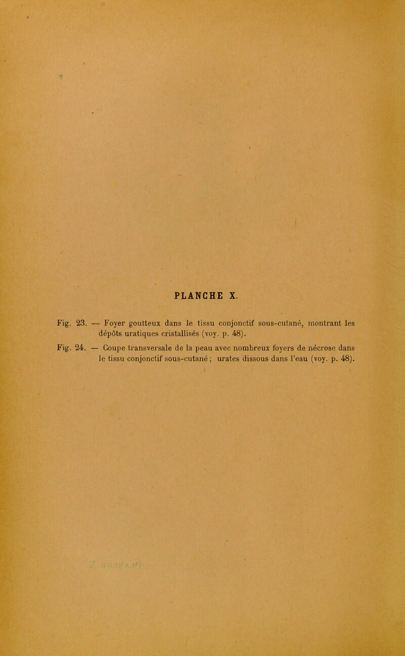 Fig. 23. — Foyer goutteux dans le tissu conjonctif sous-cutané, montrant les dépôts uratiques cristallisés (voy. p. 48). Fig. 24. — Coupe transversale de la peau avec nombreux foyers de nécrose dans le tissu conjonctif sous-cutané ; urates dissous dans l’eau (voy. p. 48). I