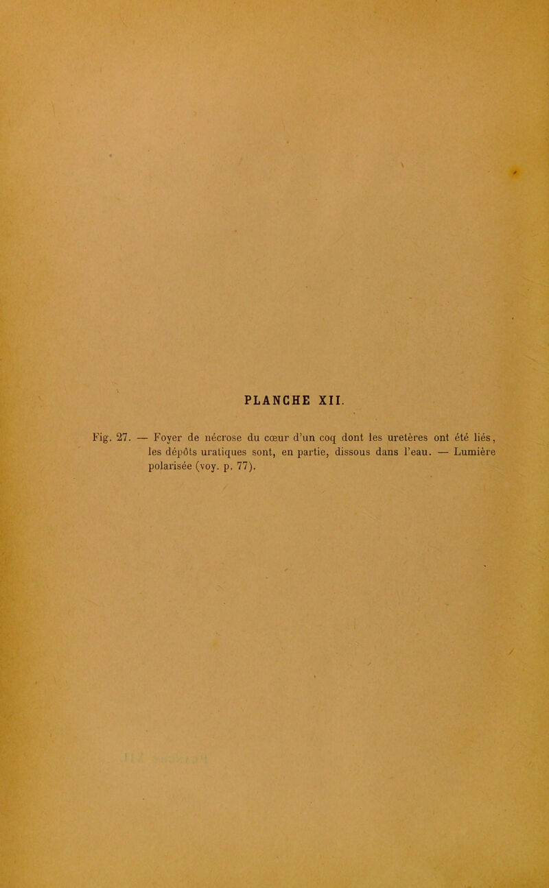 Fig. 27. — Foyer de nécrose du cœur d’un coq dont les uretères ont été liés, les dépôts uraliques sont, en partie, dissous dans l’eau. — Lumière polarisée (voy. p. 77).