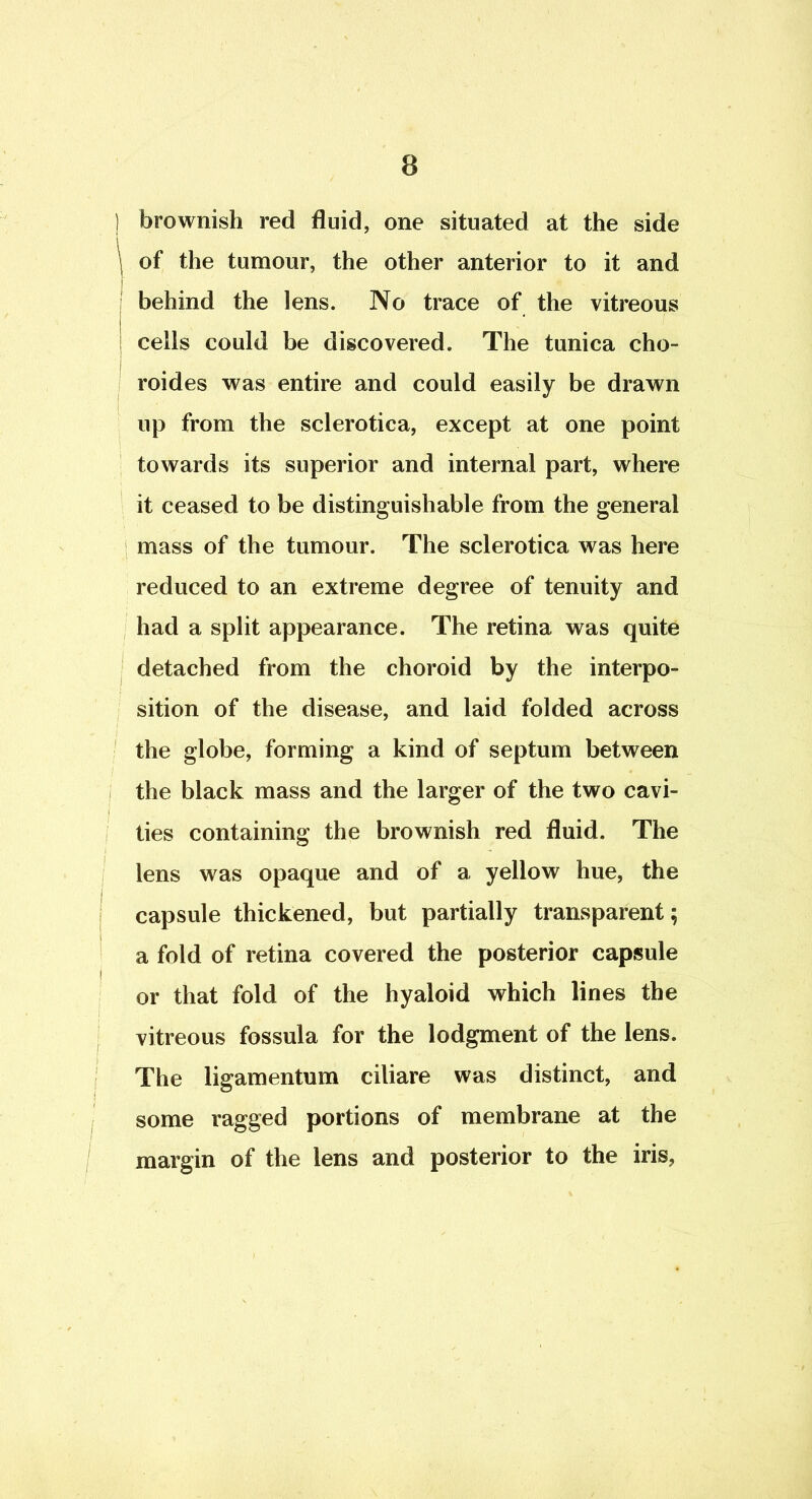 1 brownish red fluid, one situated at the side of the tumour, the other anterior to it and behind the lens. No trace of the vitreous cells could be discovered. The tunica cho- roides was entire and could easily be drawn up from the sclerotica, except at one point towards its superior and internal part, where it ceased to be distinguishable from the general I mass of the tumour. The sclerotica was here reduced to an extreme degree of tenuity and , had a split appearance. The retina was quite , detached from the choroid by the interpo- sition of the disease, and laid folded across ' the globe, forming a kind of septum between the black mass and the larger of the two cavi- ties containing the brownish red fluid. The lens was opaque and of a yellow hue, the capsule thickened, but partially transparent; a fold of retina covered the posterior capsule or that fold of the hyaloid which lines the vitreous fossula for the lodgment of the lens. The ligamentum ciliare was distinct, and some ragged portions of membrane at the margin of the lens and posterior to the iris,
