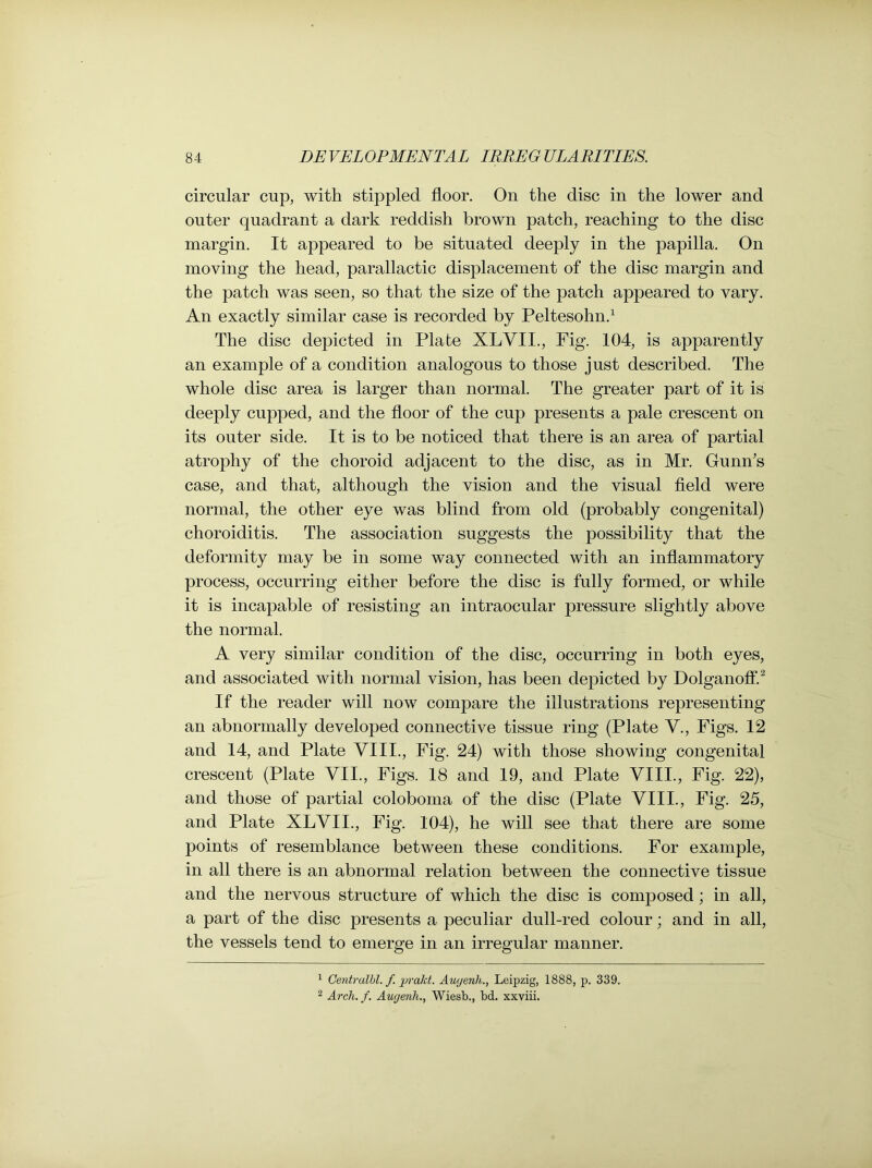 circular cup, with stippled floor. On the disc in the lower and outer quadrant a dark reddish brown patch, reaching to the disc margin. It appeared to be situated deeply in the papilla. On moving the head, parallactic displacement of the disc margin and the patch was seen, so that the size of the patch appeared to vary. An exactly similar case is recorded by Peltesohn.1 The disc depicted in Plate XLVII., Fig. 104, is apparently an example of a condition analogous to those just described. The whole disc area is larger than normal. The greater part of it is deeply cupped, and the floor of the cup presents a pale crescent on its outer side. It is to be noticed that there is an area of partial atrophy of the choroid adjacent to the disc, as in Mr. Gunn's case, and that, although the vision and the visual field were normal, the other eye was blind from old (probably congenital) choroiditis. The association suggests the possibility that the deformity may be in some way connected with an inflammatory process, occurring either before the disc is fully formed, or while it is incapable of resisting an intraocular pressure slightly above the normal. A very similar condition of the disc, occurring in both eyes, and associated with normal vision, has been depicted by Dolganoff.2 If the reader will now compare the illustrations representing an abnormally developed connective tissue ring (Plate V., Figs. 12 and 14, and Plate VIII., Fig. 24) with those showing congenital crescent (Plate VII., Figs. 18 and 19, and Plate VIII., Fig. 22), and those of partial coloboma of the disc (Plate VIII., Fig. 25, and Plate XLVII., Fig. 104), he will see that there are some points of resemblance between these conditions. For example, in all there is an abnormal relation between the connective tissue and the nervous structure of which the disc is composed; in all, a part of the disc presents a peculiar dull-red colour; and in all, the vessels tend to emerge in an irregular manner. 1 Centralbl. f. prakt. Auyenli., Leipzig, 1888, p. 339. 2 Arch. f. Aucjenli., Wiesb., bd. xxviii.
