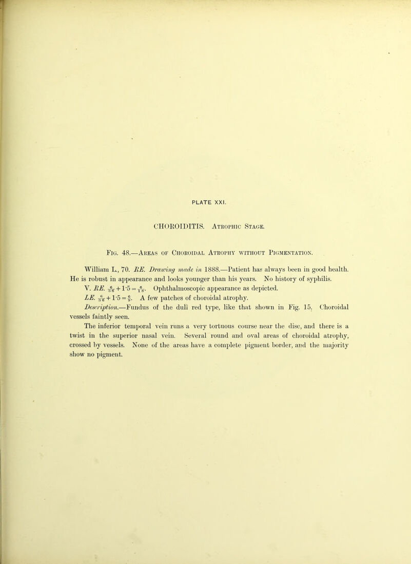 CHOROIDITIS. Atrophic Stage. Fig. 48.—Areas of Choroidal Atrophy without Pigmentation. William L., 70. RE. Drawing made in 1888.—Patient has always been in good health. He is robust in appearance and looks younger than his years. No history of syphilis. V. RE. y6g- +1-5 = XV Ophthalmoscopic appearance as depicted. LE. Ts\+ 1\5 = ■§•. A few patches of choroidal atrophy. Description.—Fundus of the dull red type, like that shown in Fig. 15. Choroidal vessels faintly seen. The inferior temporal vein runs a very tortuous course near the disc, and there is a twist in the superior nasal vein. Several round and oval areas of choroidal atrophy, crossed by vessels. None of the areas have a complete pigment border, and the majority show no pigment.