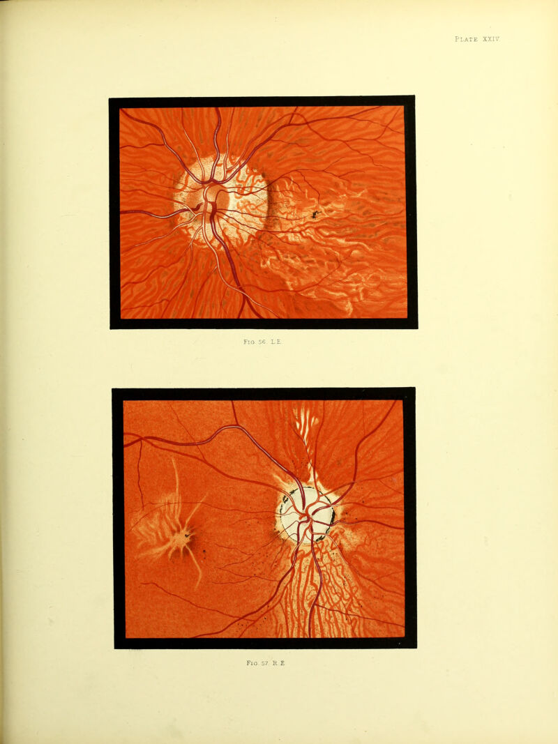 Fig. 56. L.E